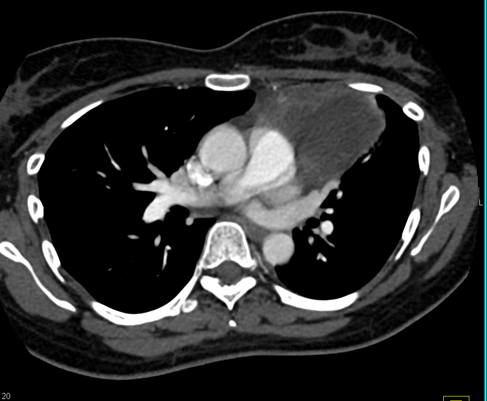 CTisus Quiz