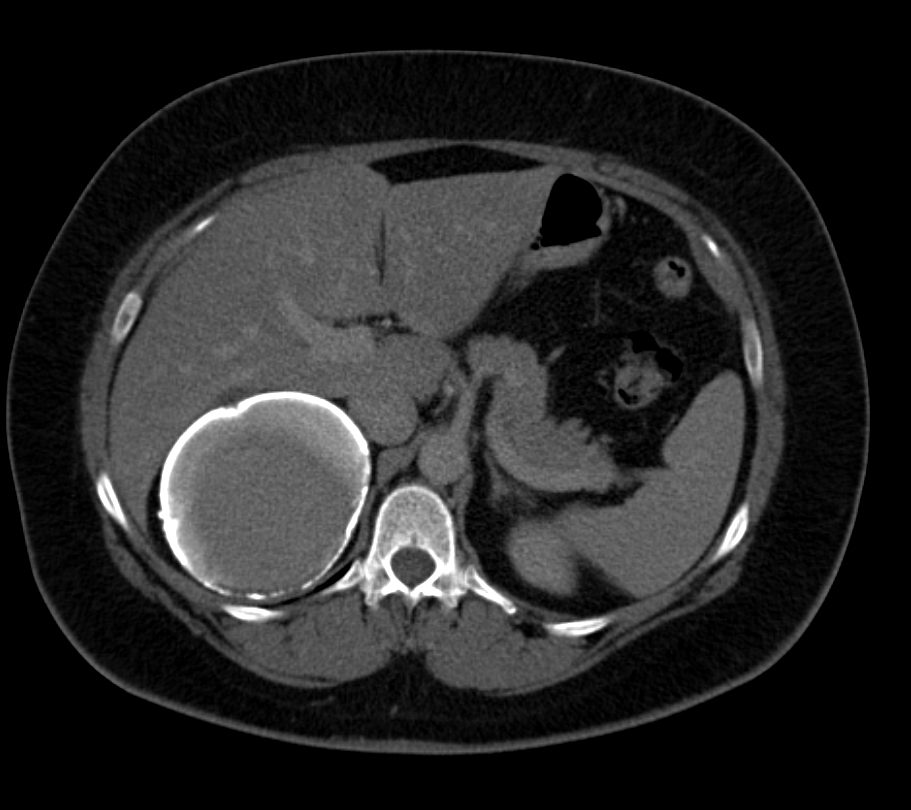 CTisus Quiz