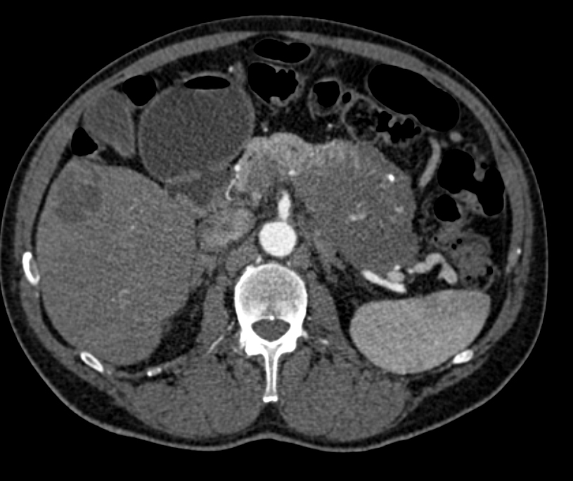 CTisus Quiz