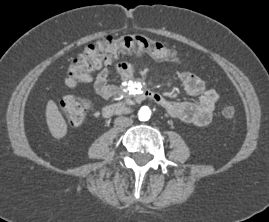 CTisus Quiz