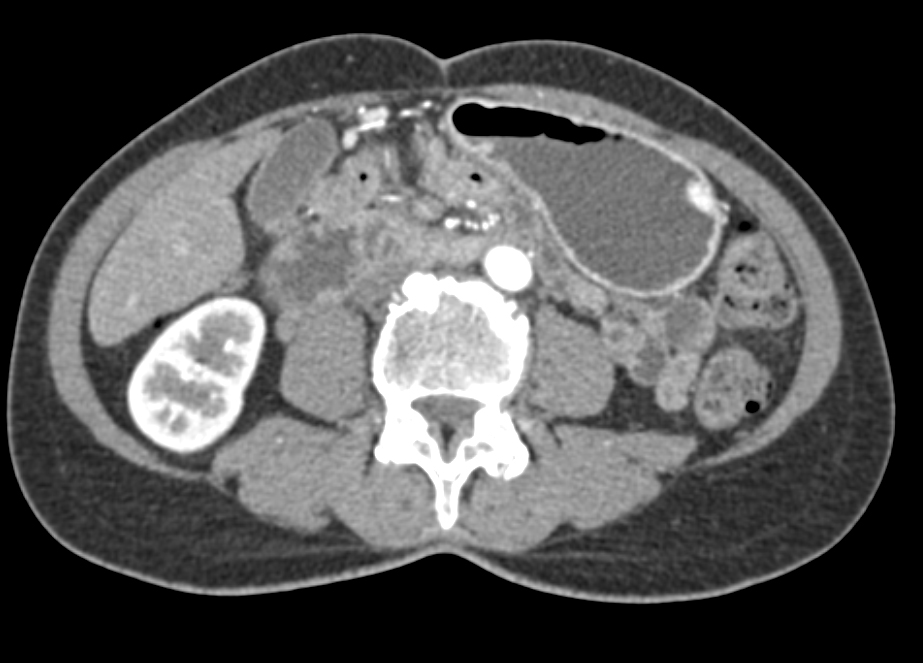 CTisus Quiz
