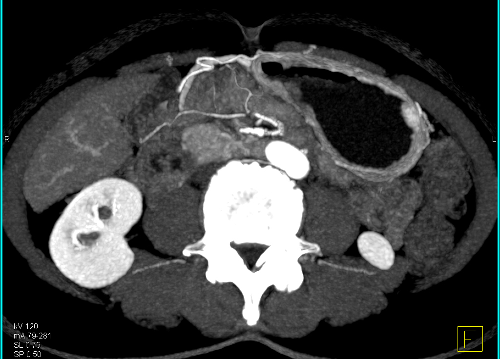 CTisus Quiz