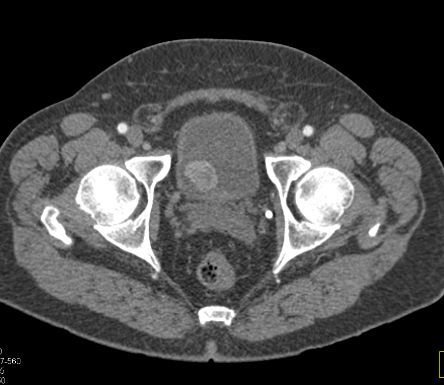 CTisus Quiz