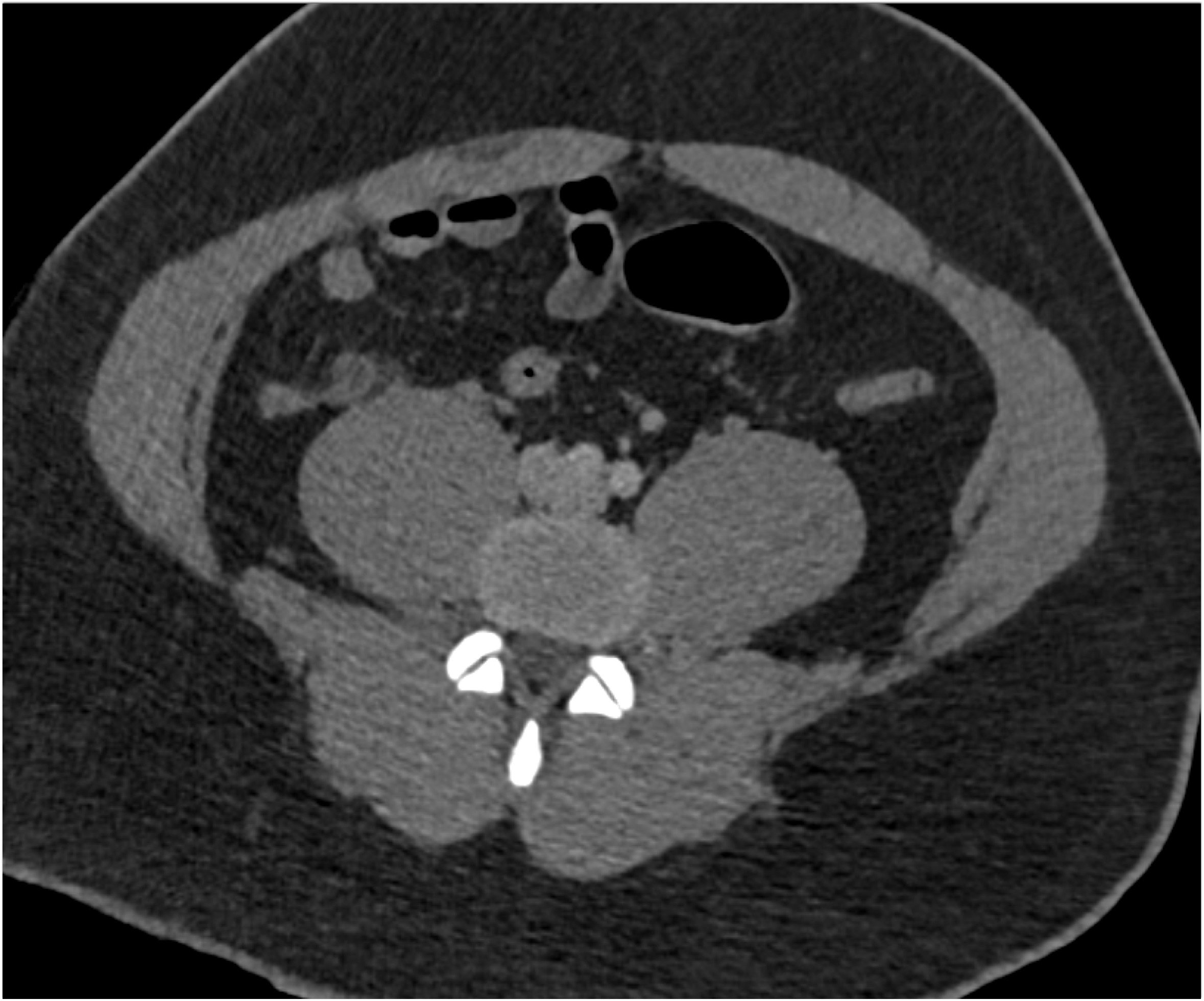 CTisus Quiz