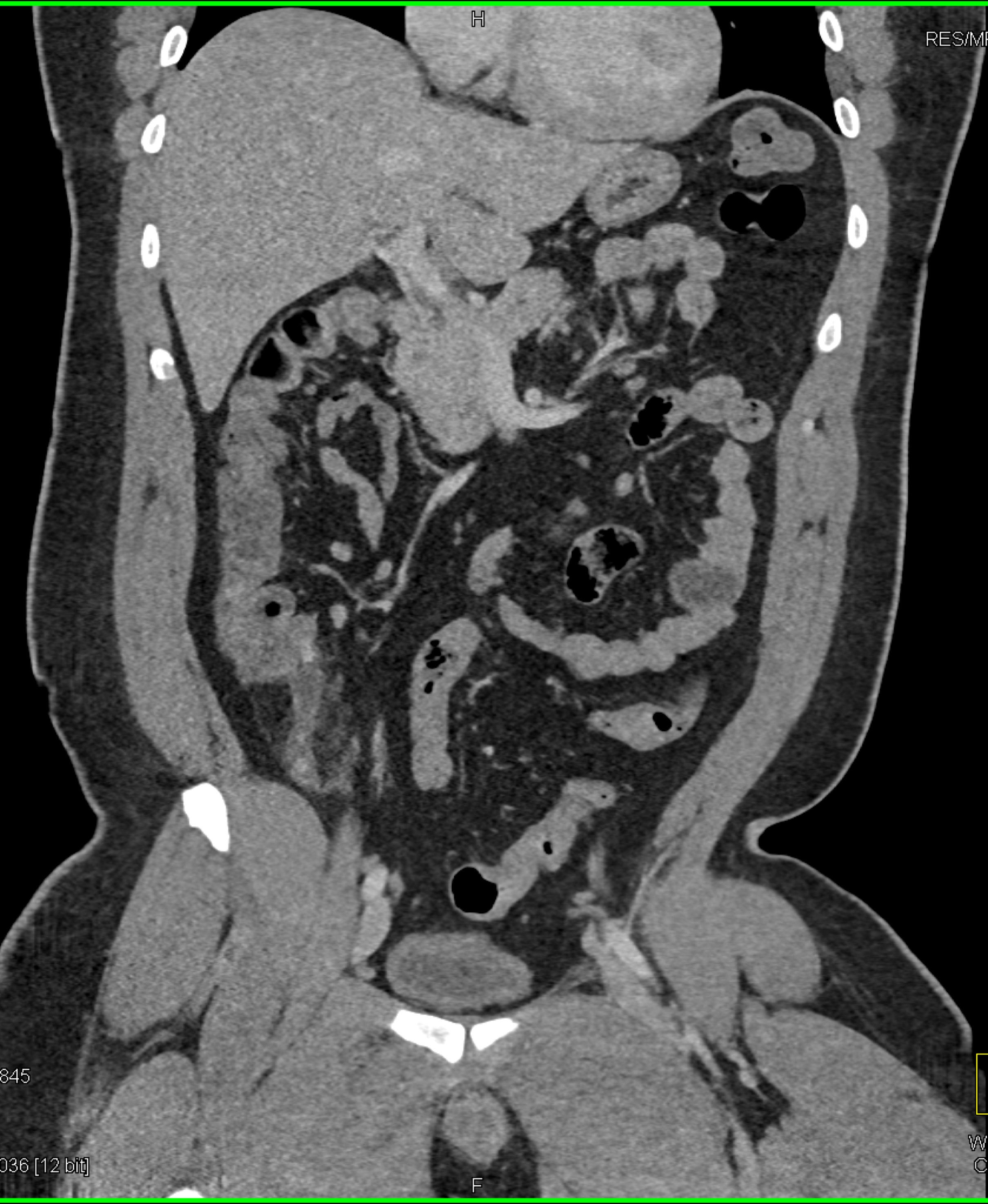 CTisus Quiz