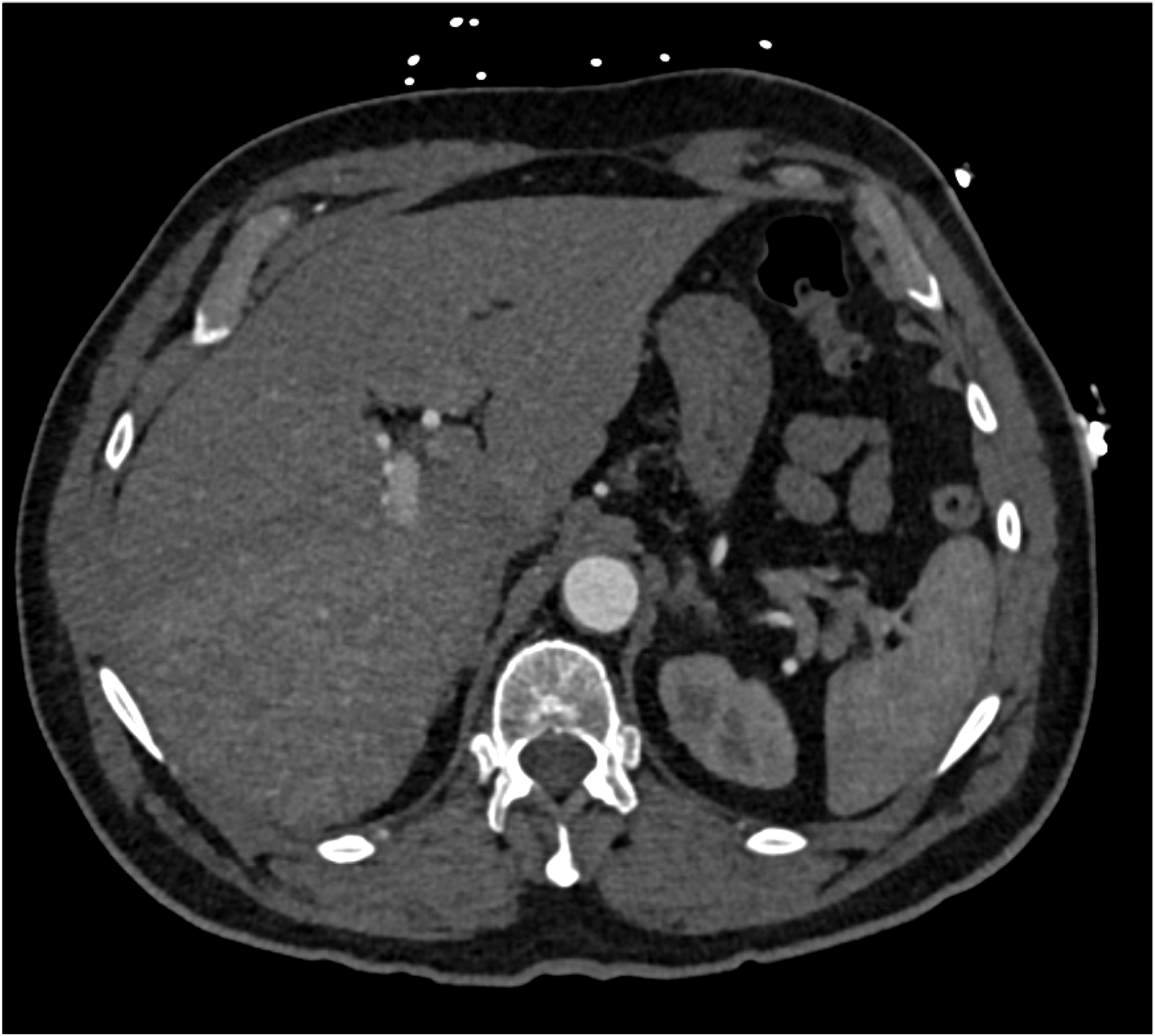 CTisus Quiz