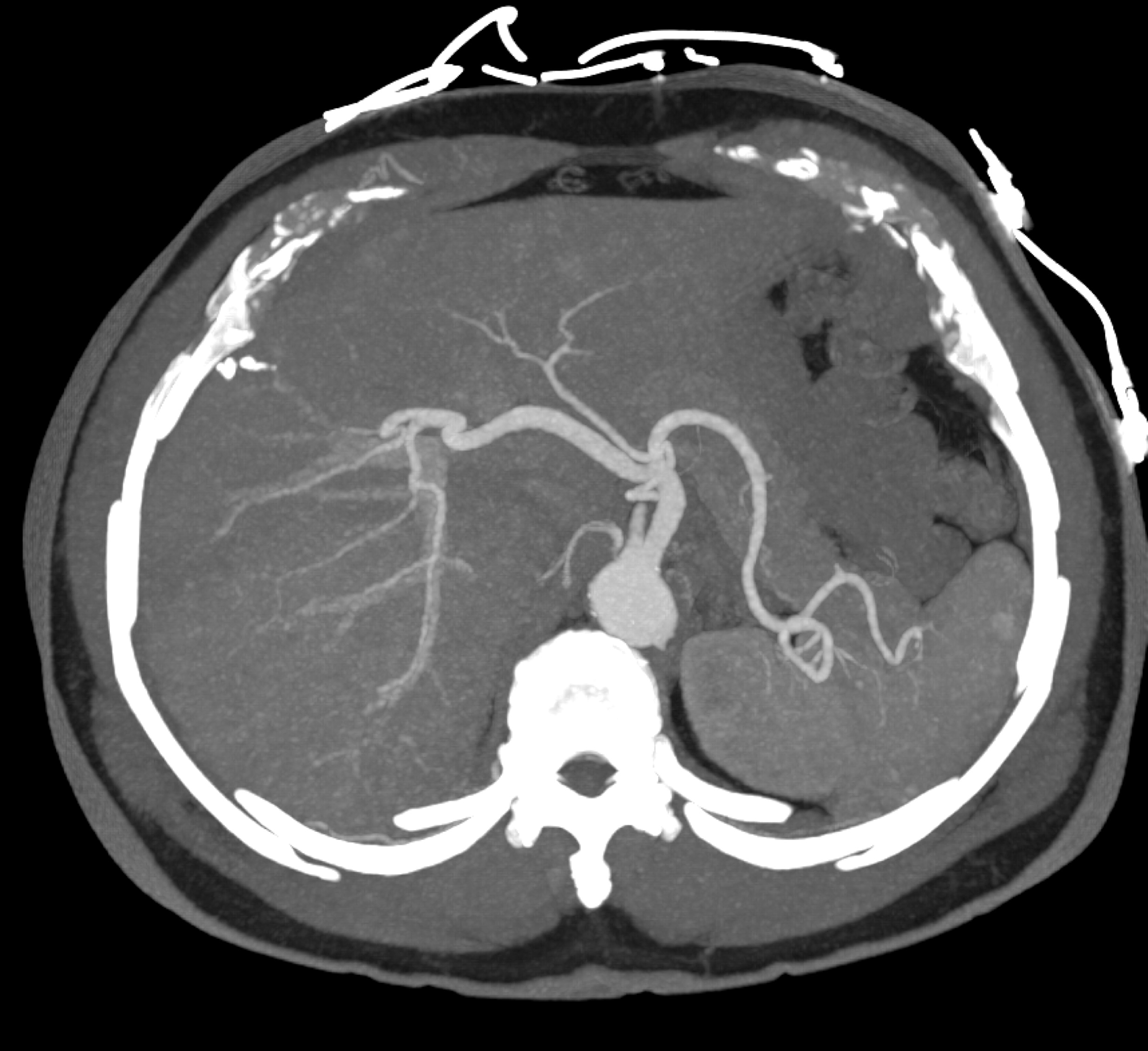 CTisus Quiz
