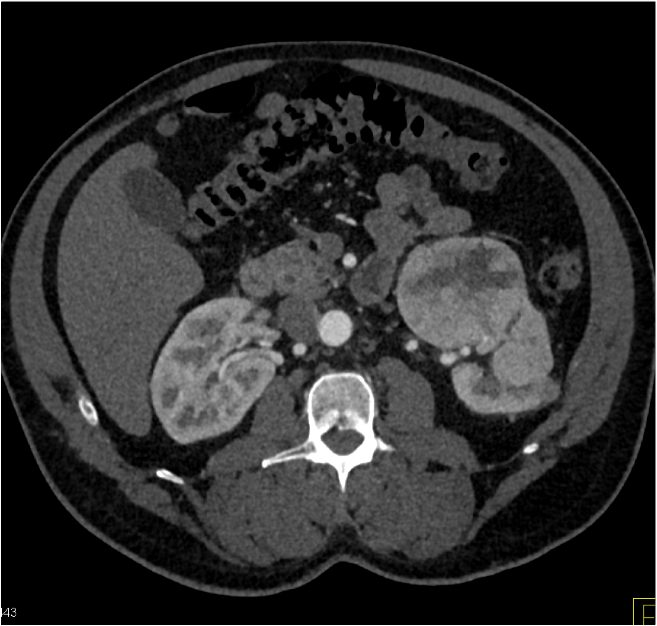CTisus Quiz