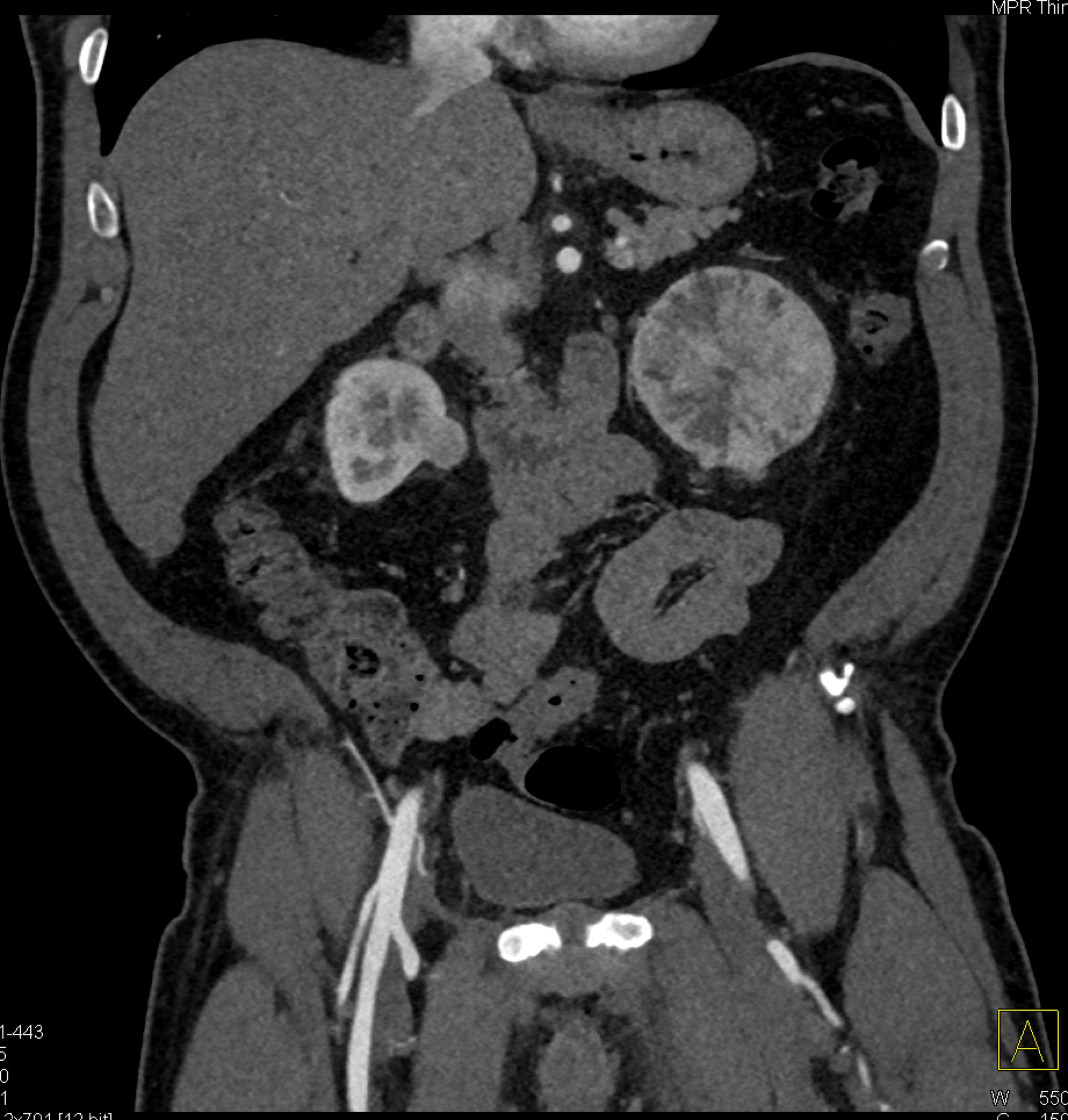 CTisus Quiz