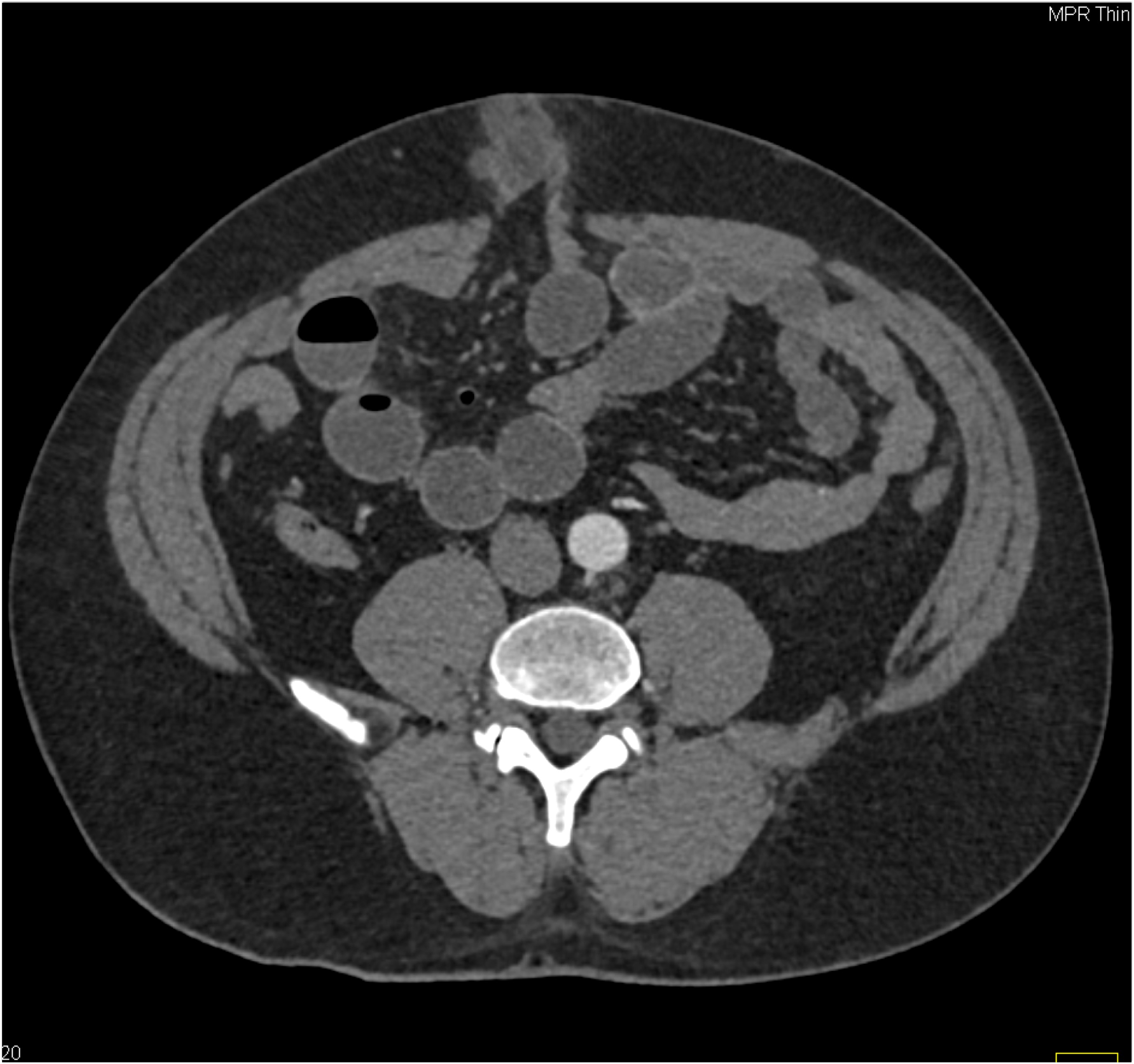 CTisus Quiz