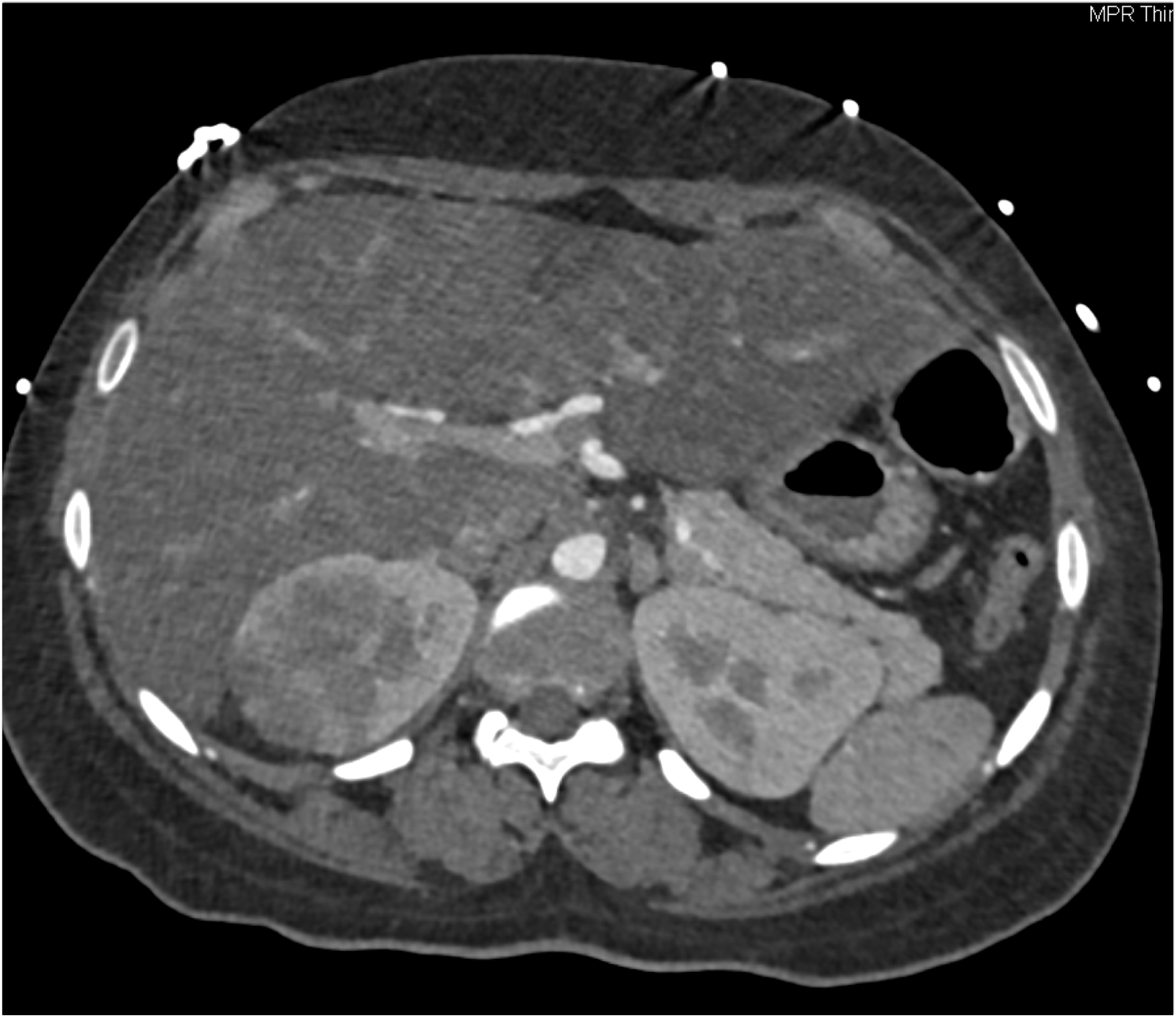 CTisus Quiz
