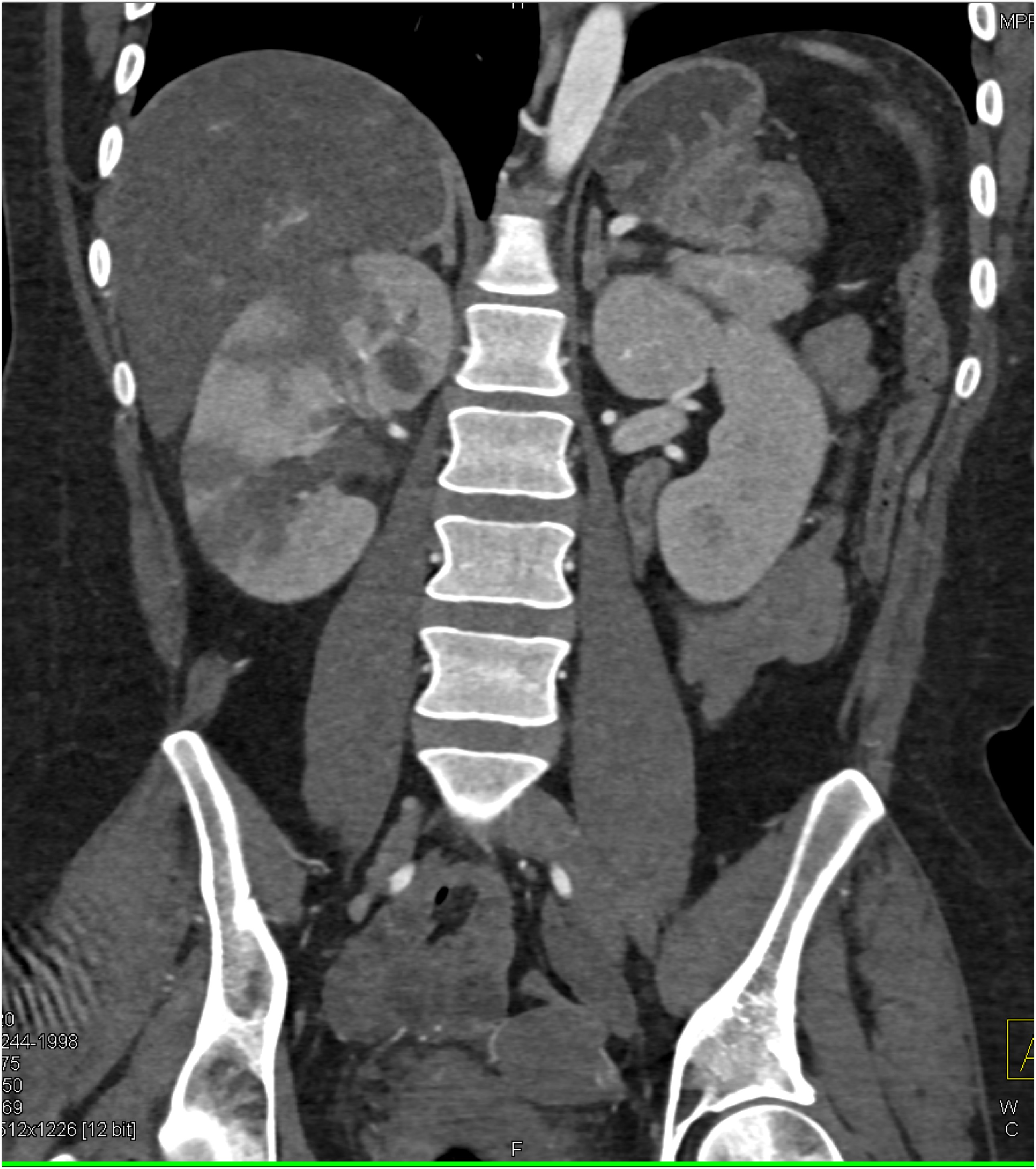 CTisus Quiz