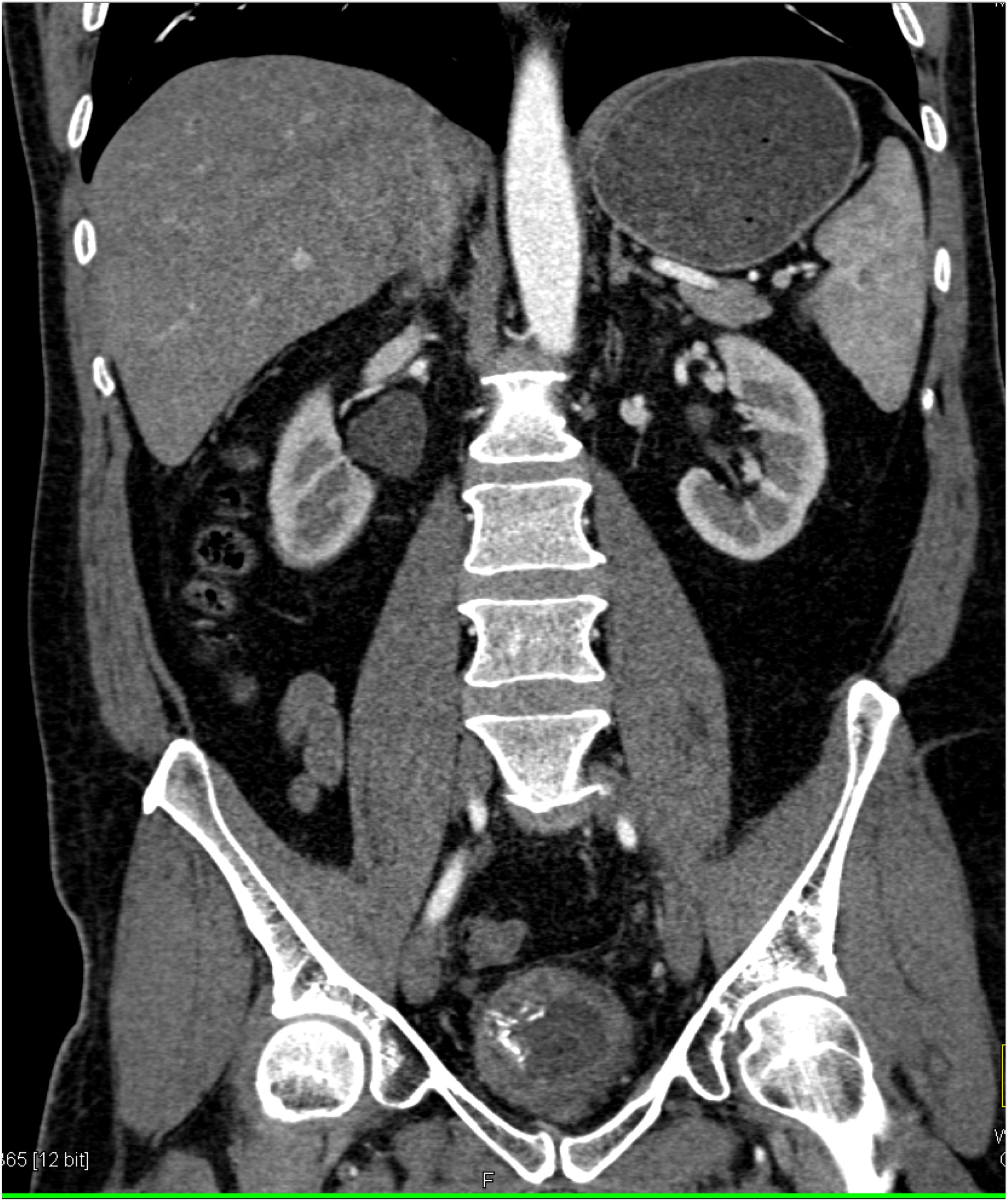 CTisus Quiz