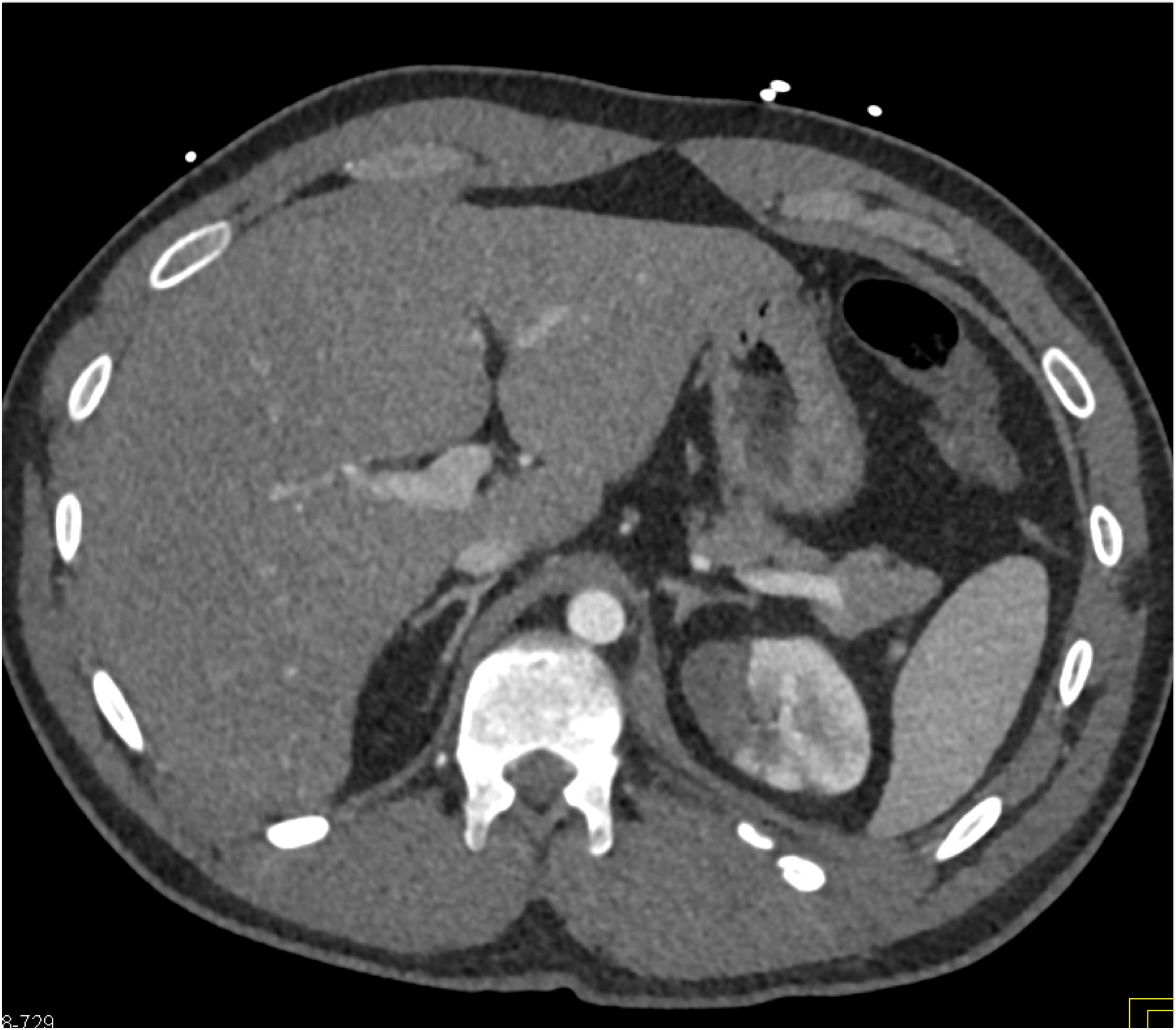 CTisus Quiz