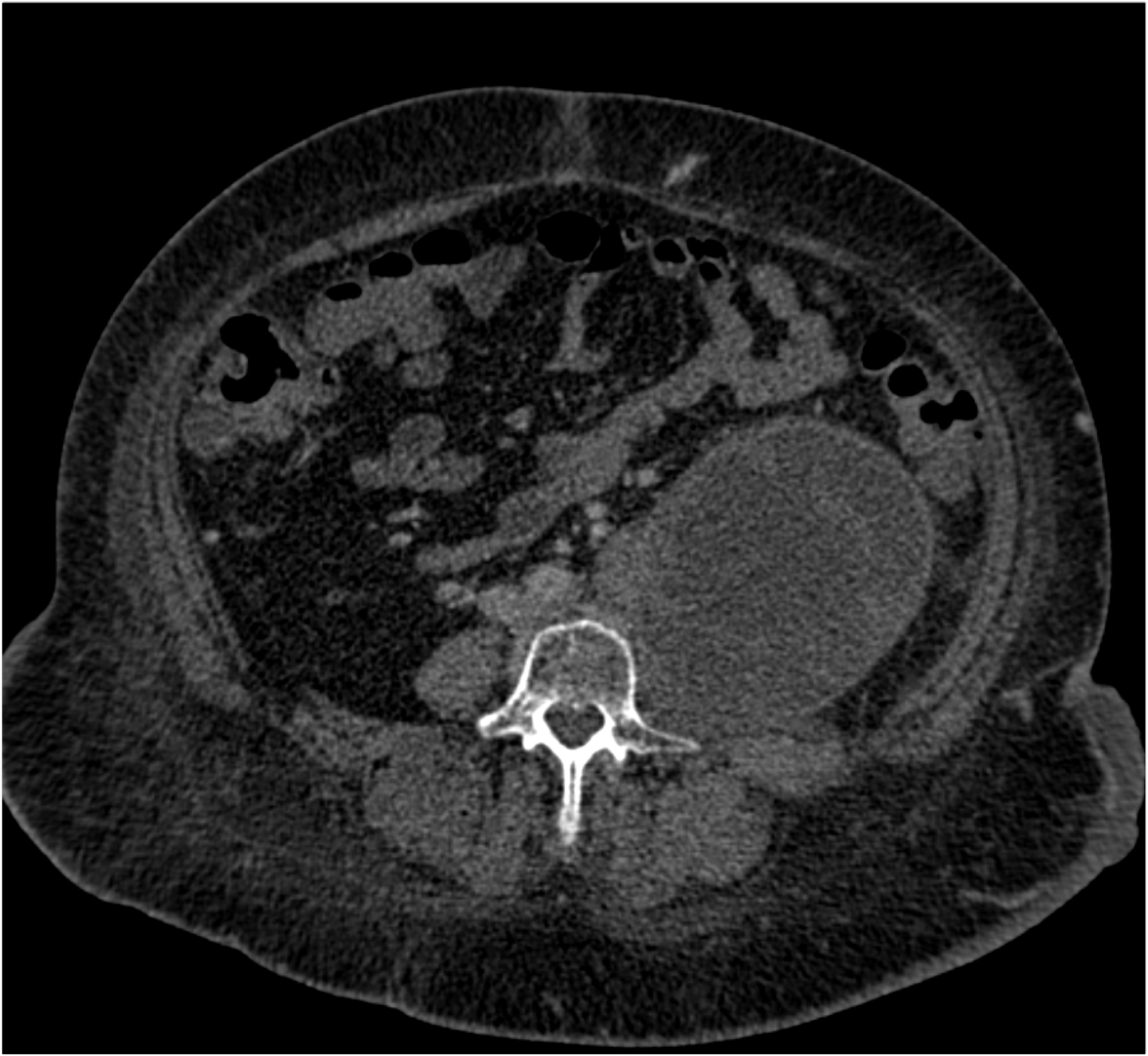 CTisus Quiz