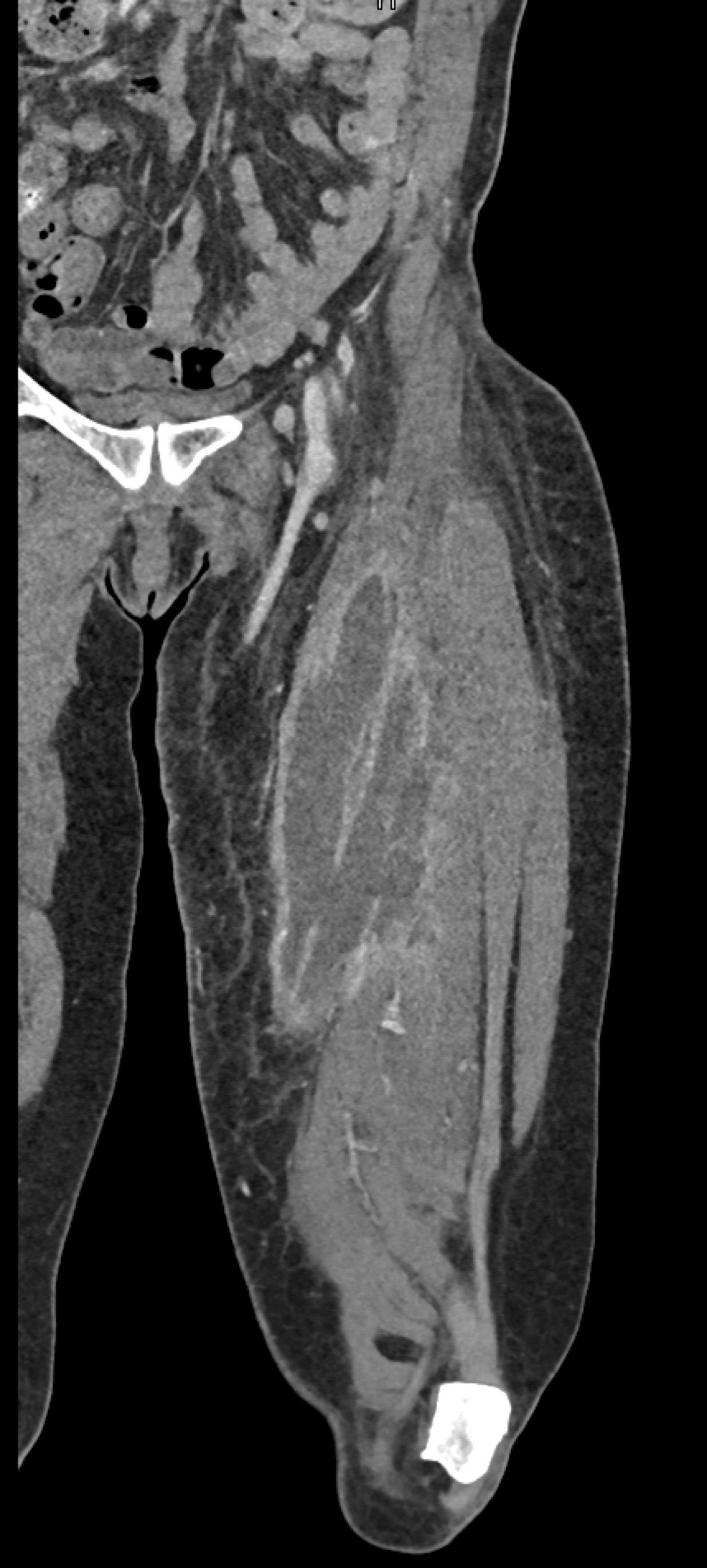 CTisus Quiz