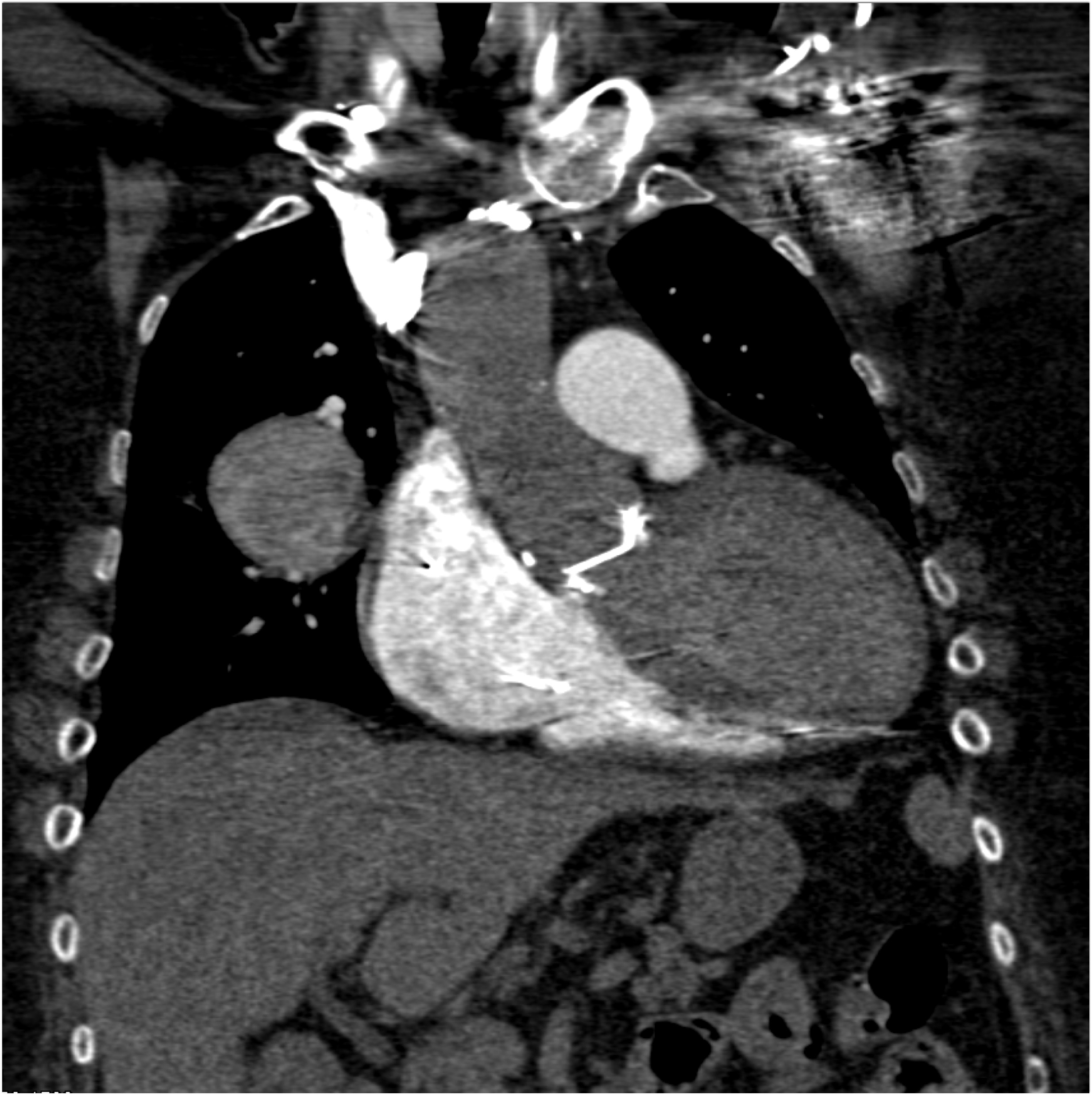 CTisus Quiz