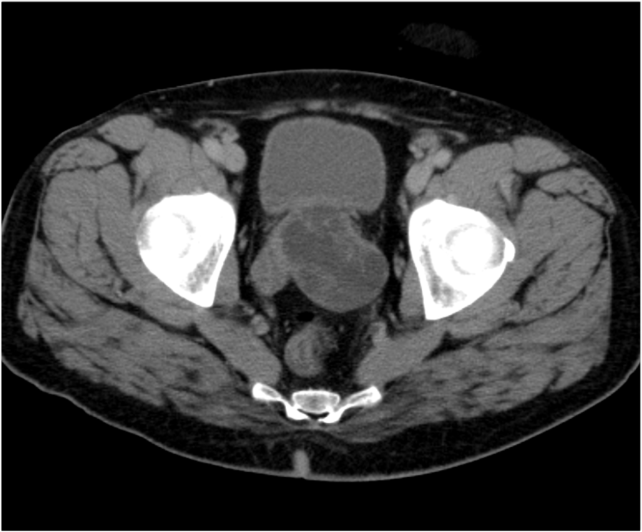 CTisus Quiz