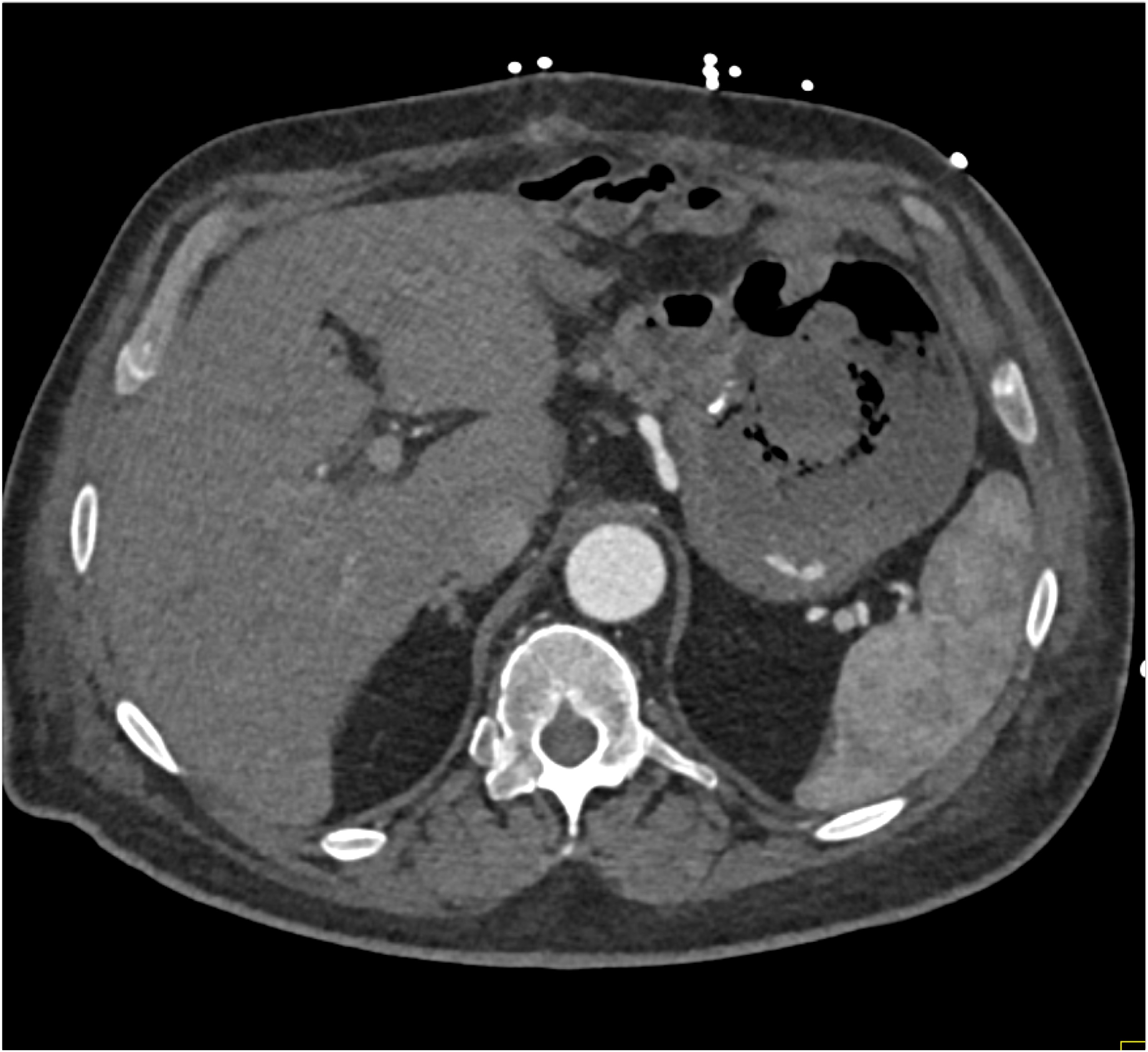 CTisus Quiz