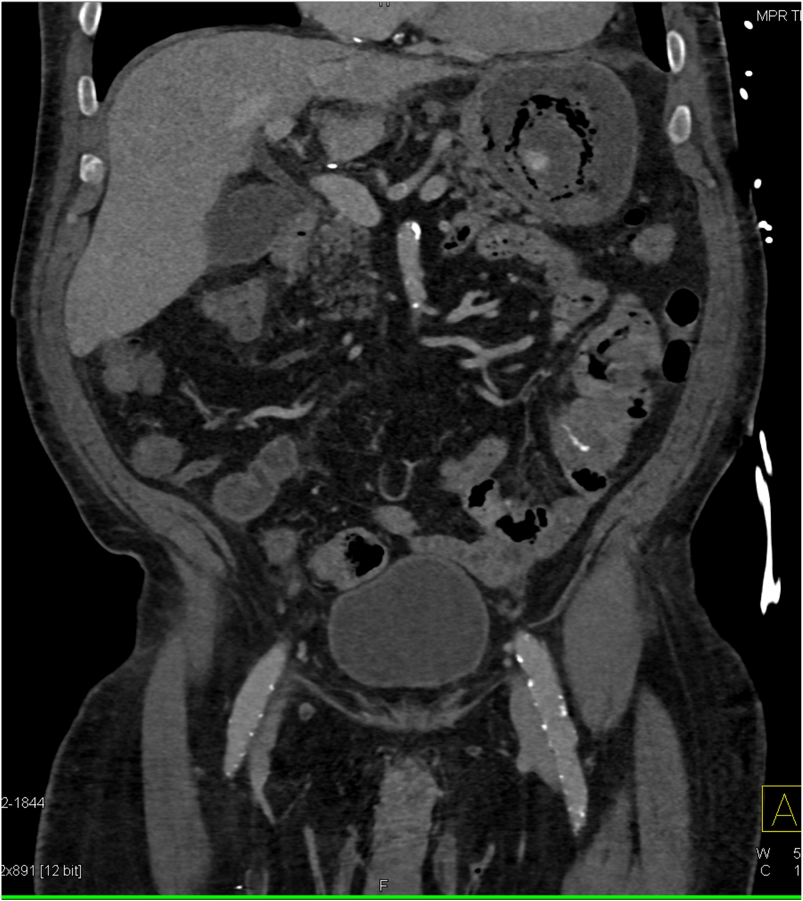 CTisus Quiz