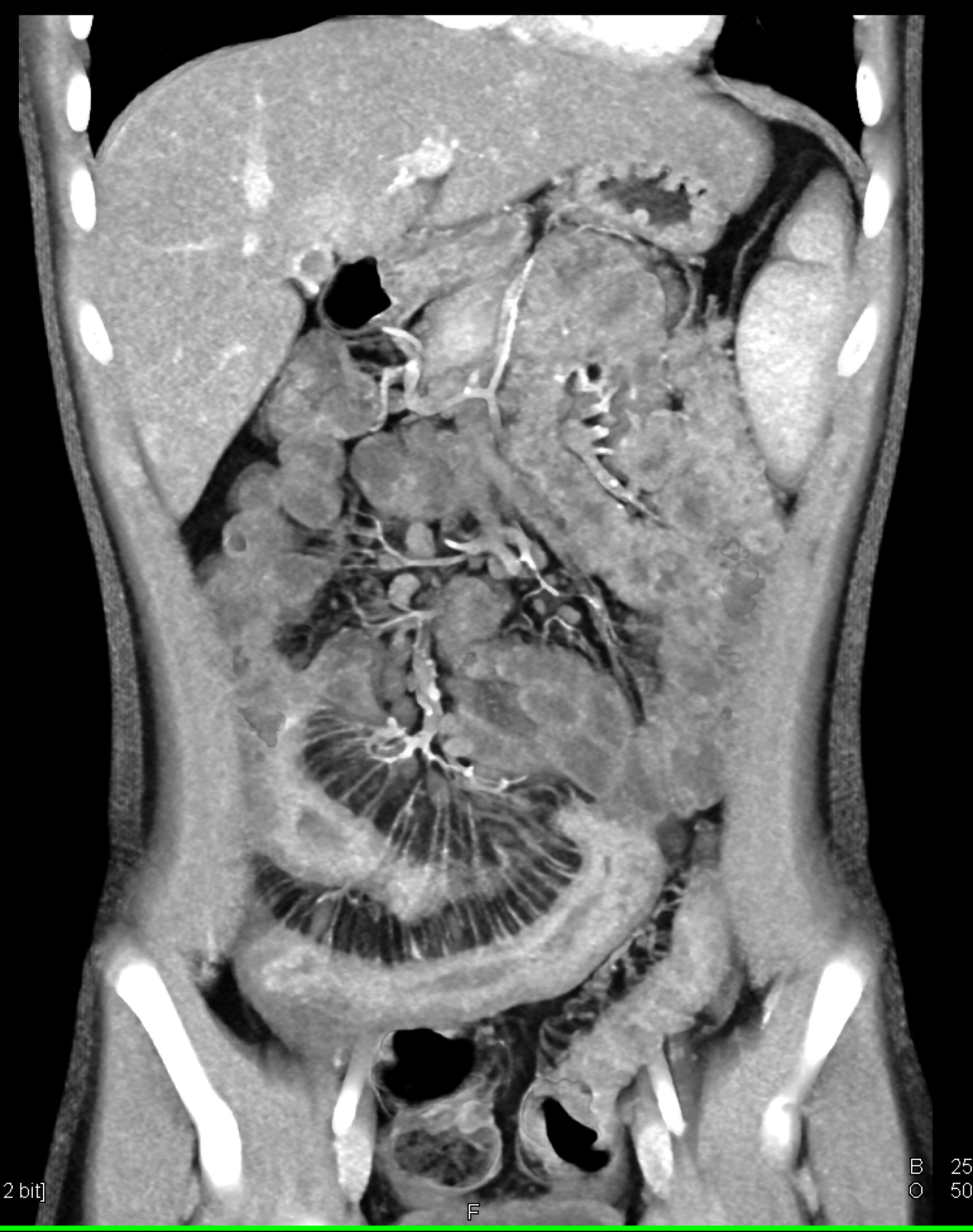 CTisus Quiz