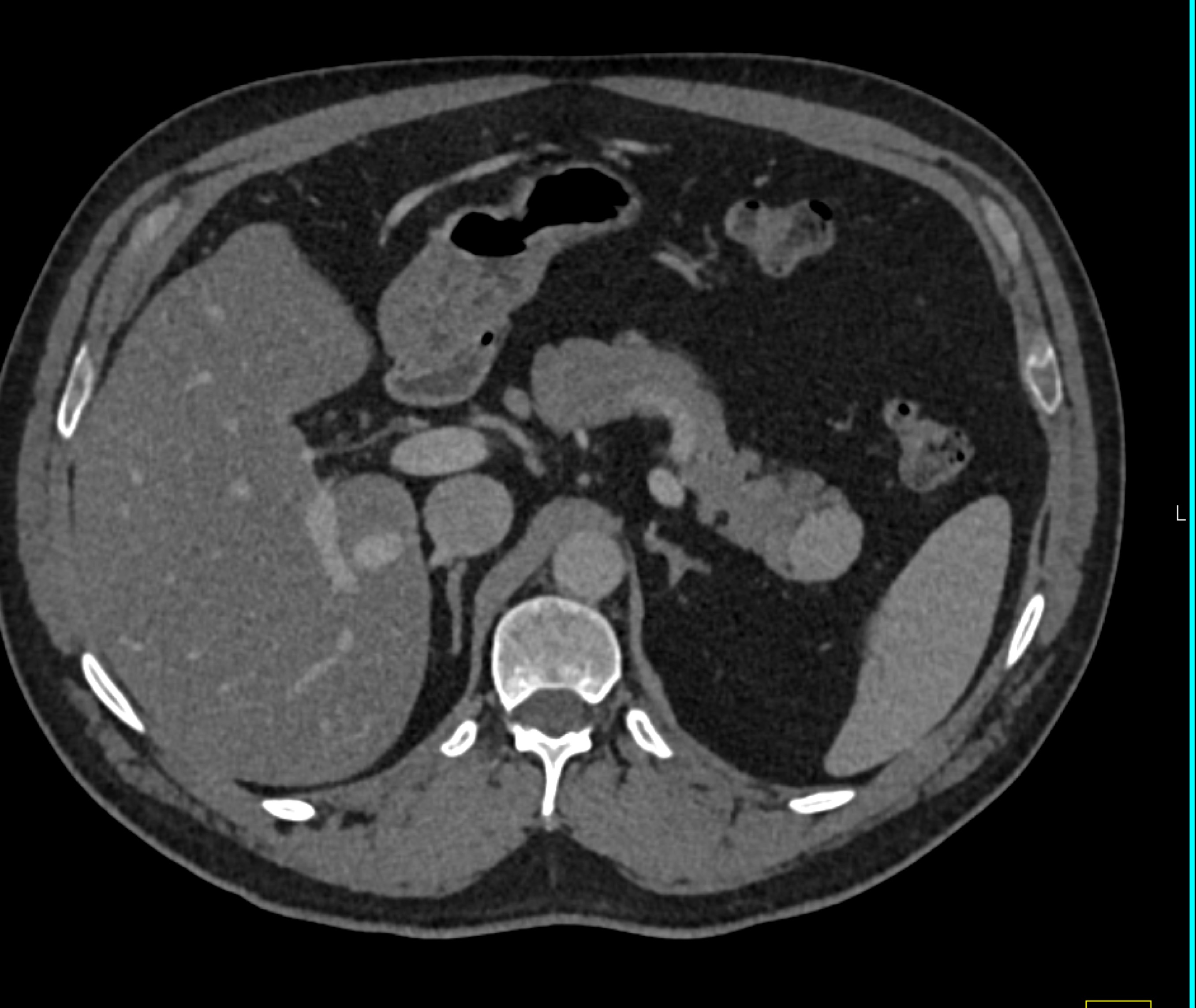 CTisus Quiz