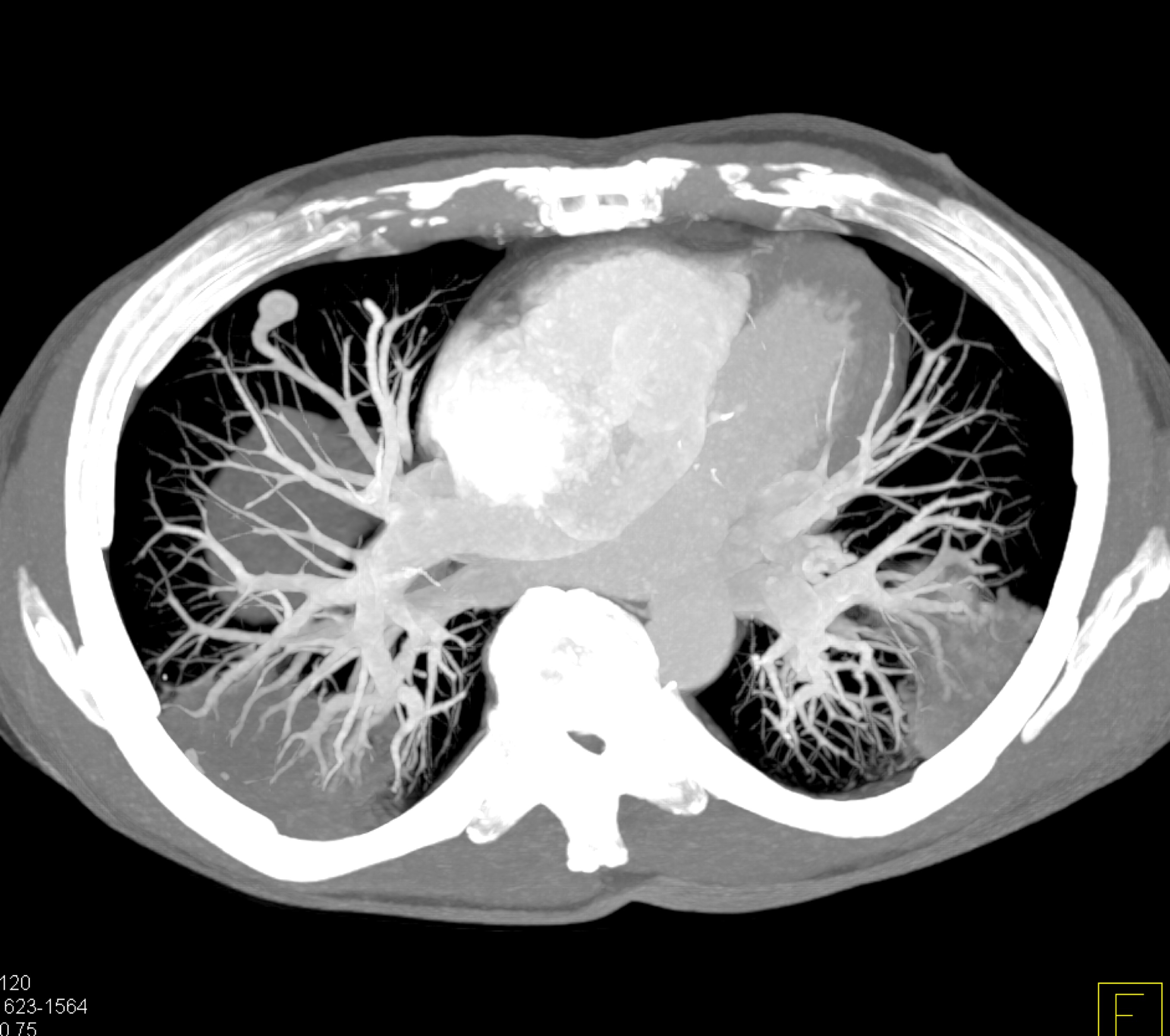 CTisus Quiz