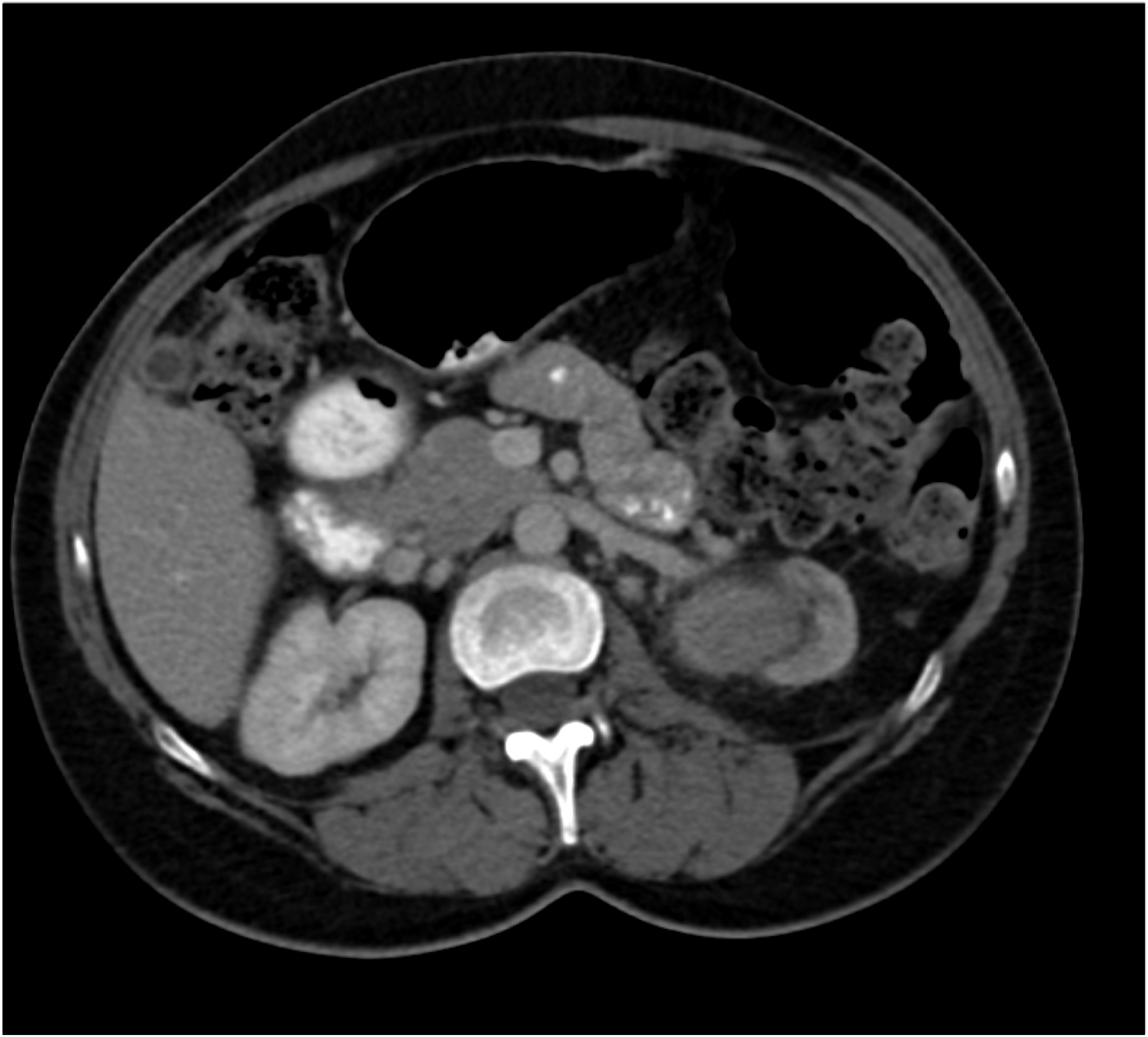 CTisus Quiz