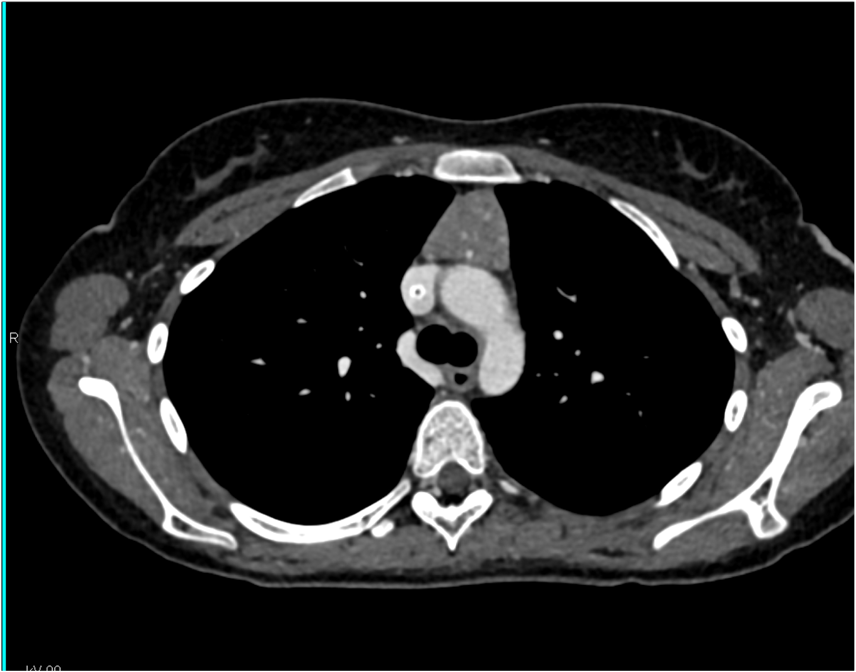 CTisus Quiz