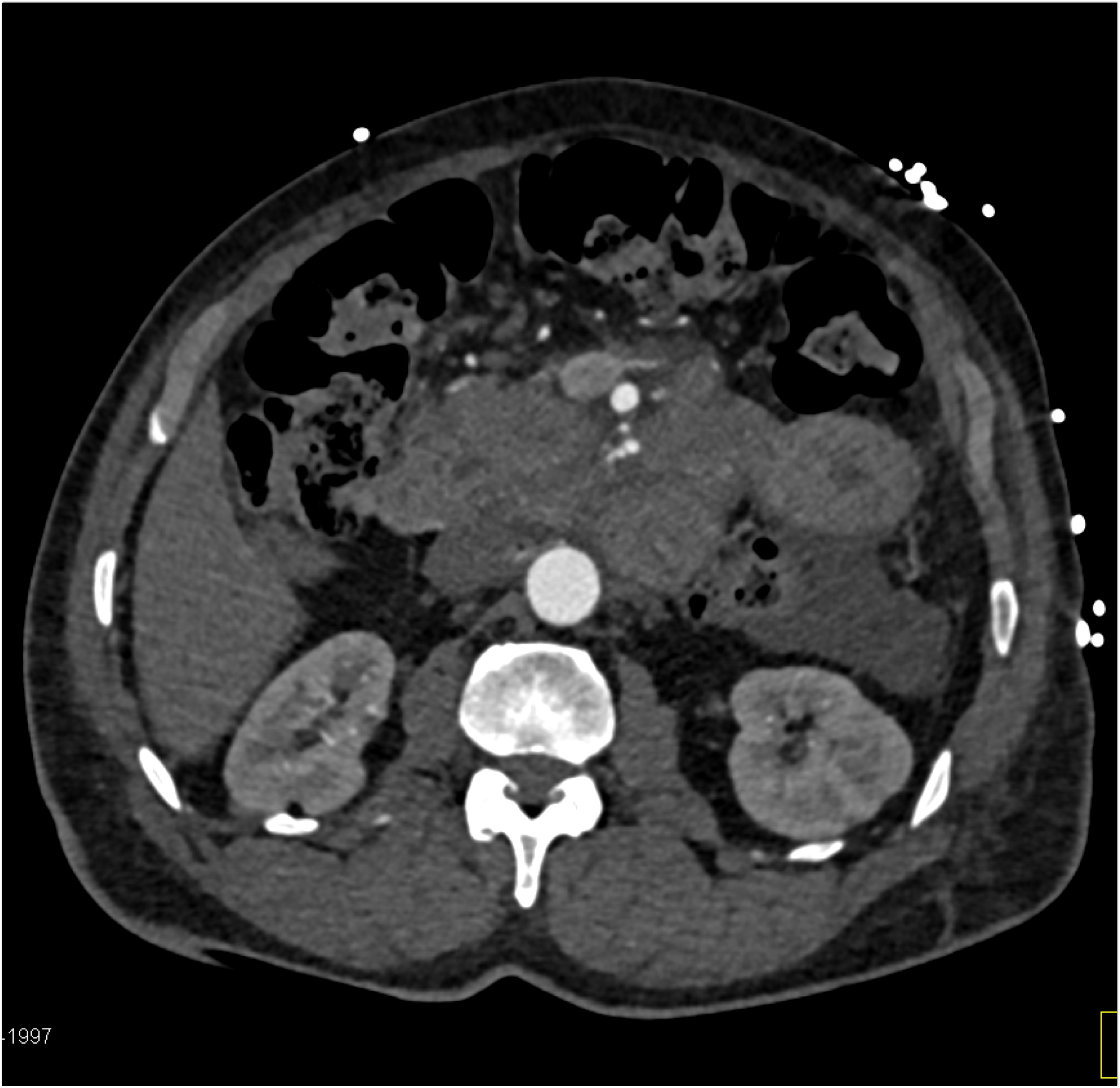 CTisus Quiz