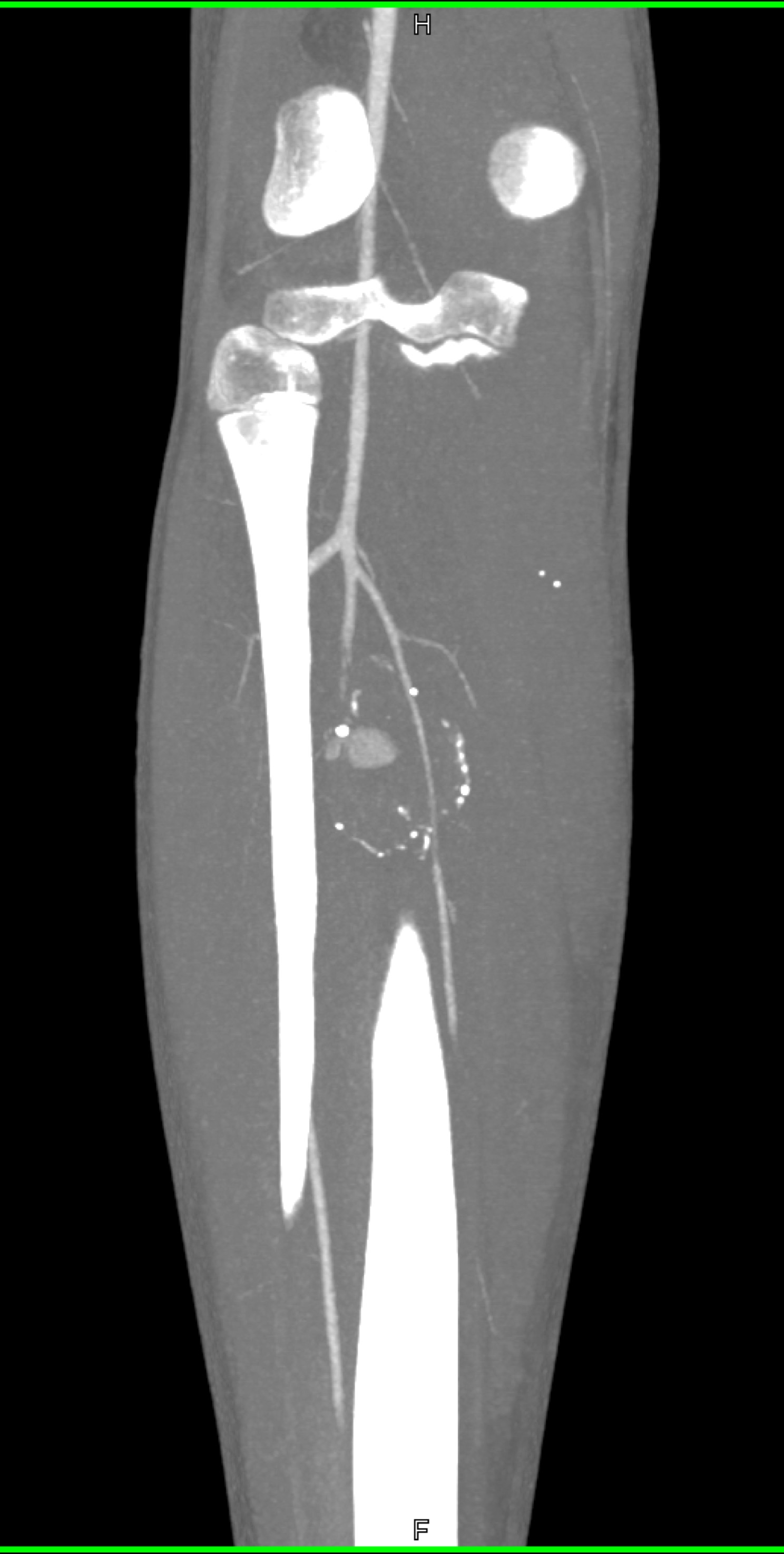 CTisus Quiz