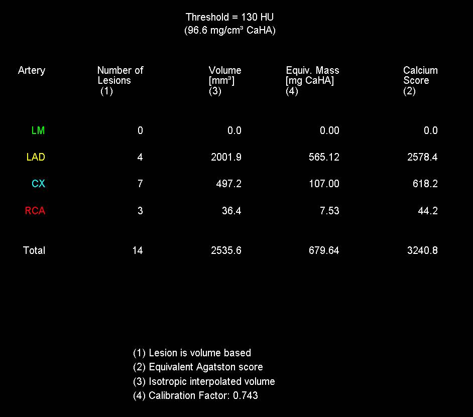 CCTA with High Agatston Score Making it Difficult to Rule Out Coronary Artery Stenosis - CTisus CT Scan