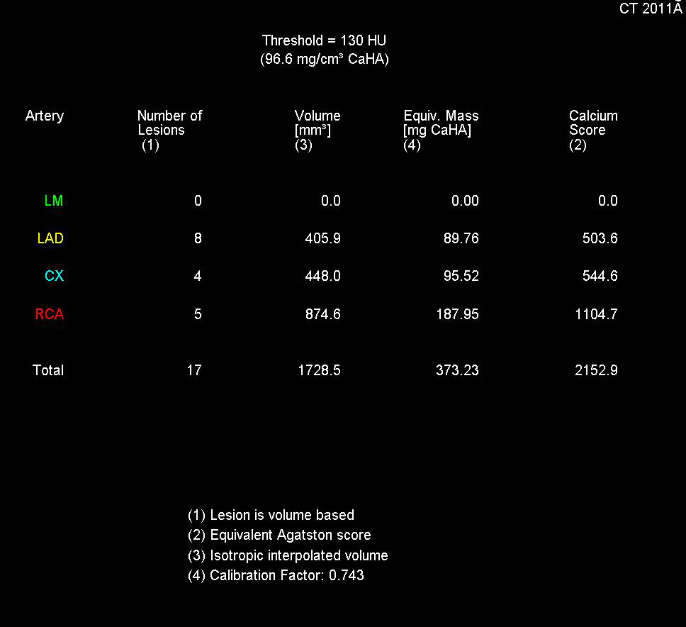 CCTA: Elevated Calcium Score with Left Anterior Descending Coronary Artery (LAD) Plaque - CTisus CT Scan