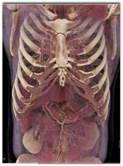 COVID-19 with Ground Glass Opacity (GGO) with Cinematic Rendering - CTisus CT Scan