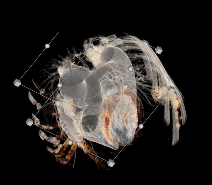 Cinematic Rendering of the Asccending Aorta - CTisus CT Scan