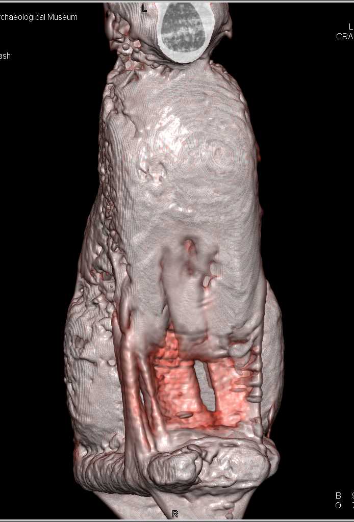 Cat Statue from Ancient Egypt - CTisus CT Scan