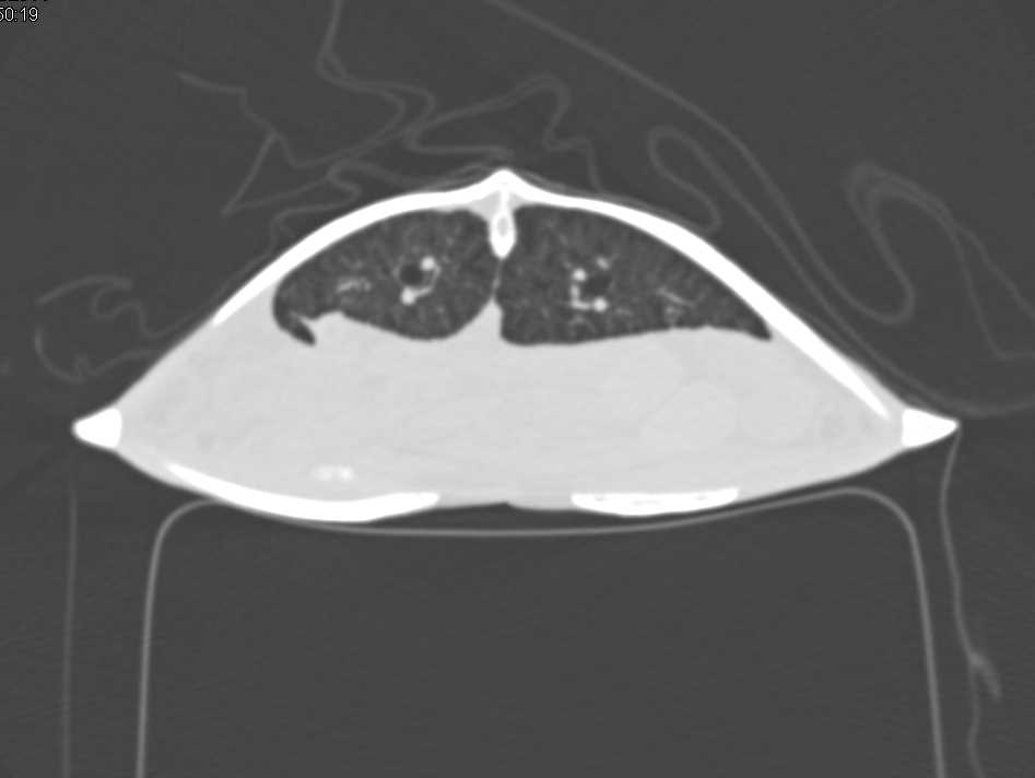Sea Turtle Without Abnormality - CTisus CT Scan