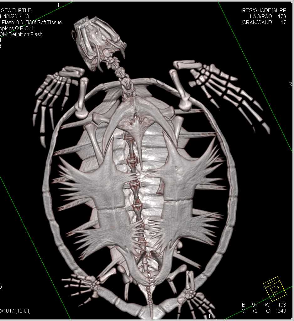 Turtle with Pulmonary Nodules - CTisus CT Scan