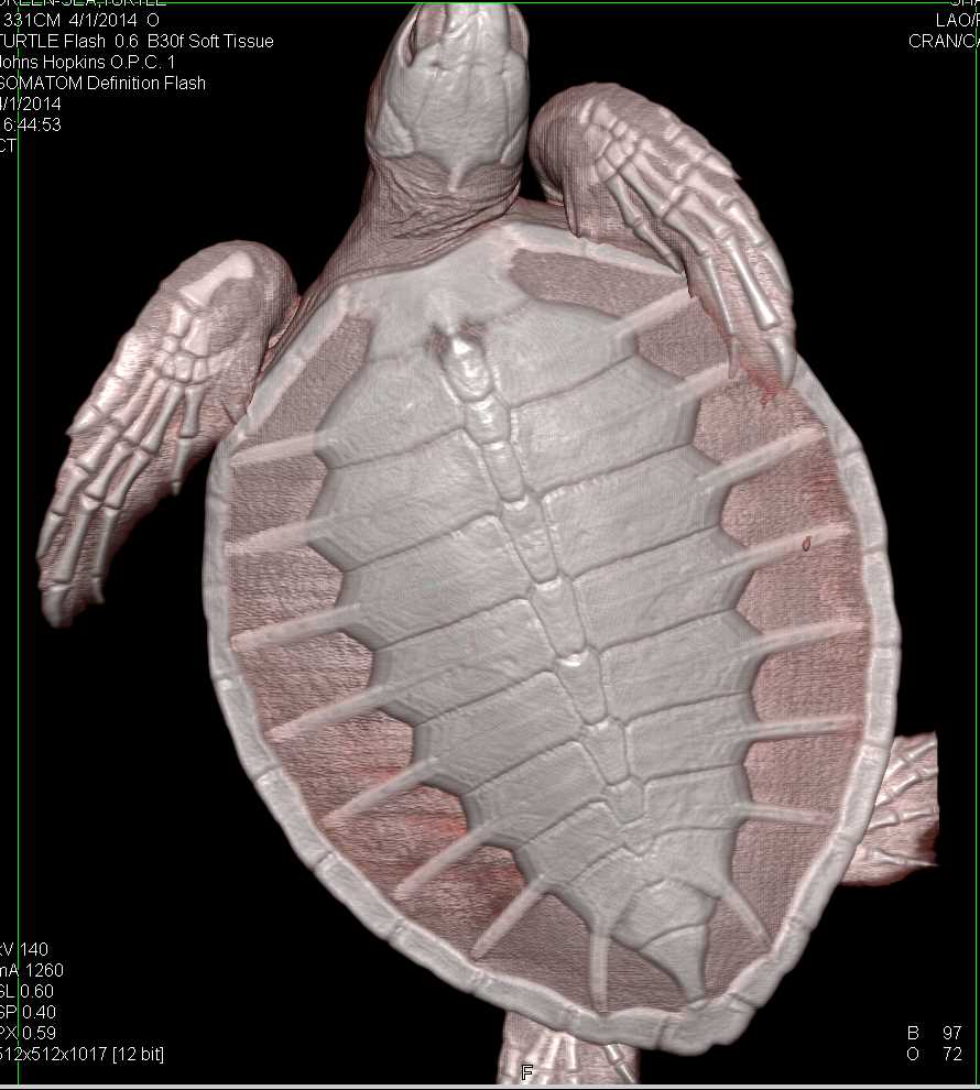 Turtle with Pulmonary Nodules - CTisus CT Scan