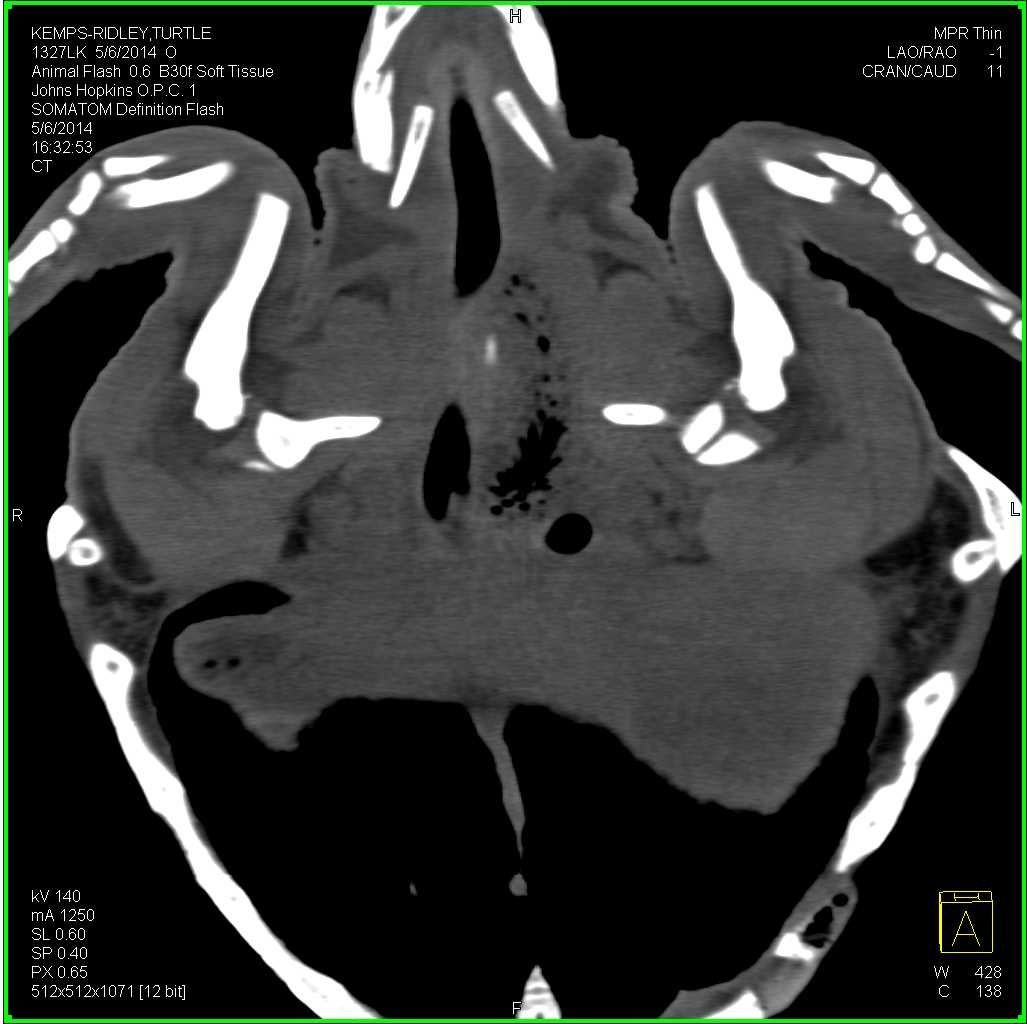 Turtle with Small Shoulder Joint Effusions - CTisus CT Scan