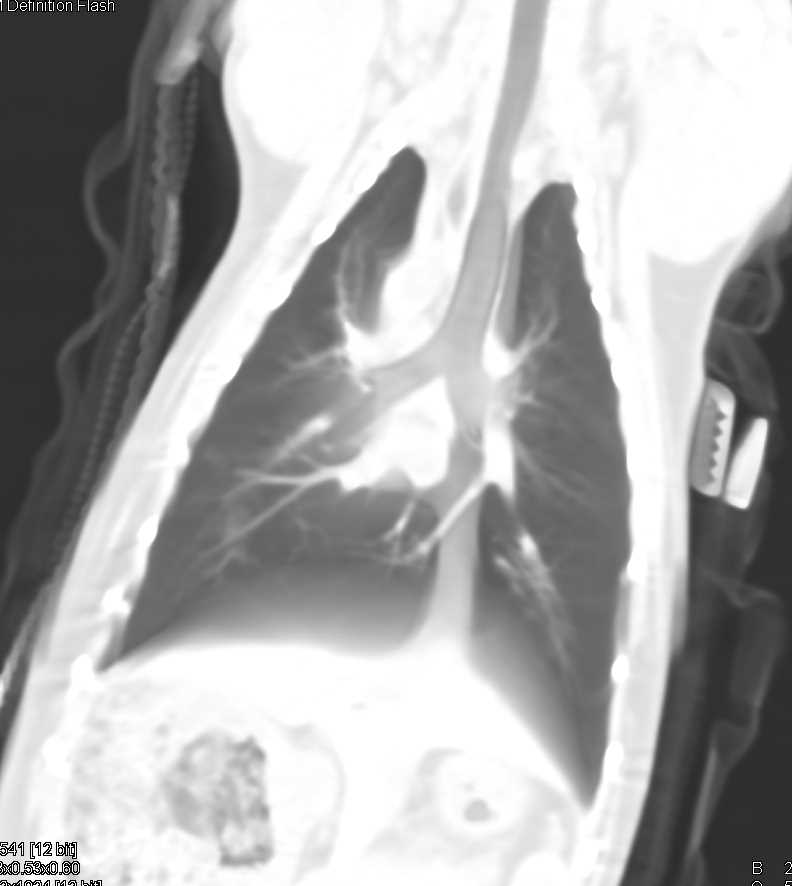 Normal Airways in a mammal - CTisus CT Scan