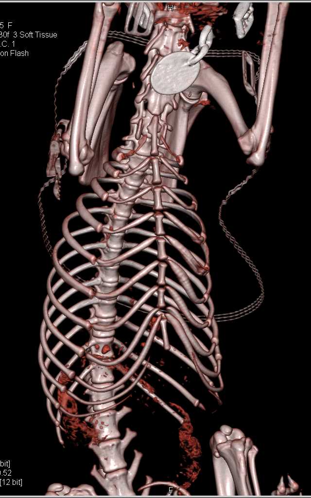Emma the Dog - CTisus CT Scan