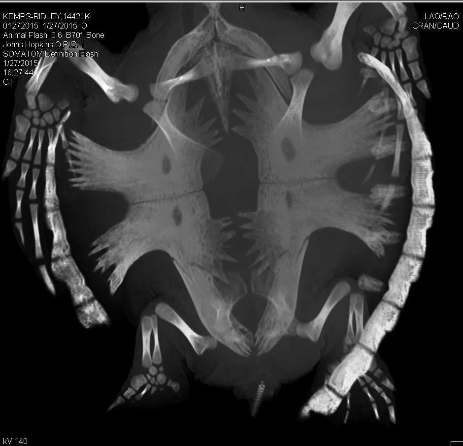 3D of a Turtle Looking for a Site of Infection - CTisus CT Scan