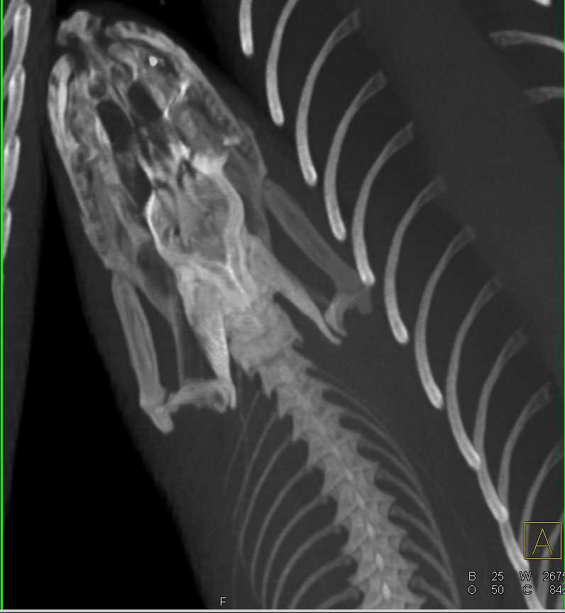 Python by the Name of Monty - CTisus CT Scan