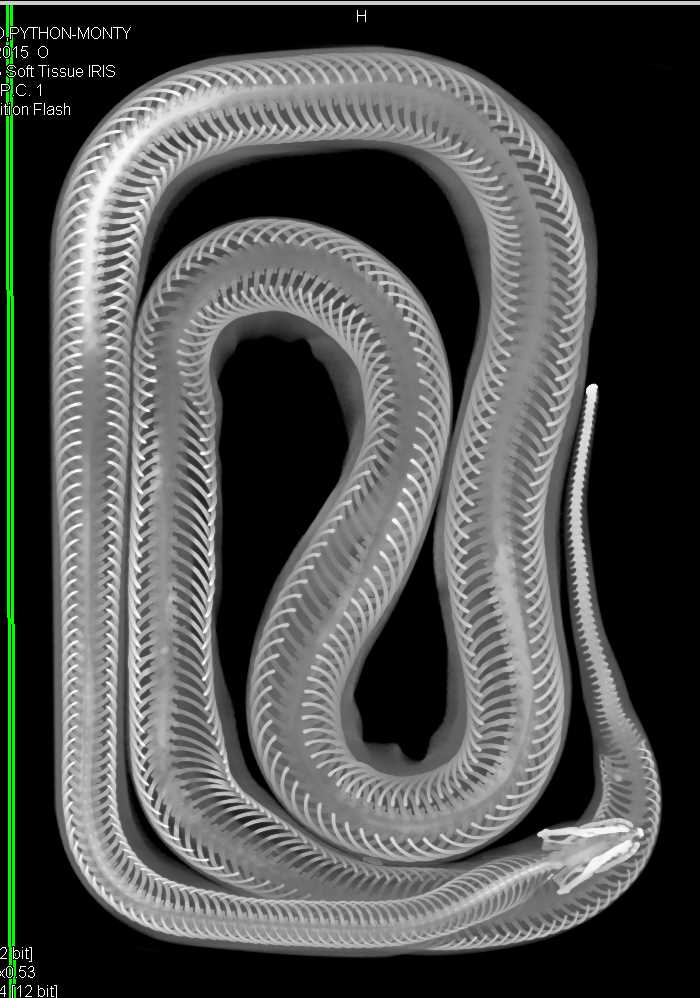 Python by the Name of Monty - CTisus CT Scan