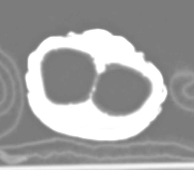 Shingleback Skink - CTisus CT Scan