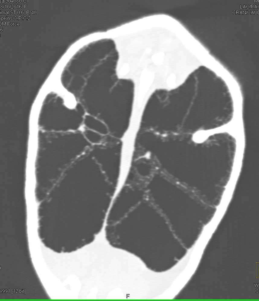 Turtle with Infected Shell - CTisus CT Scan
