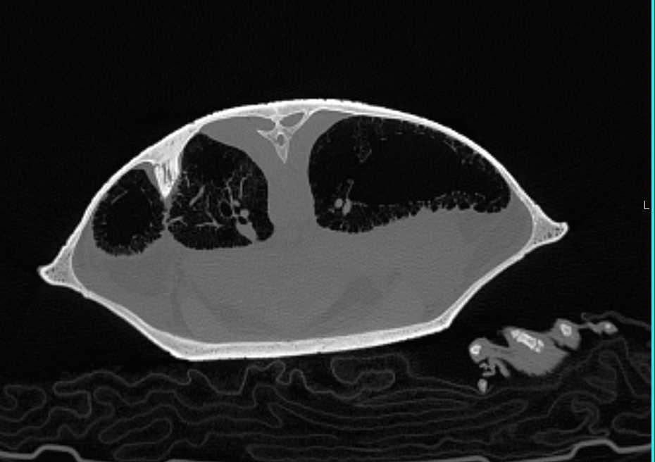 Turtle with Unusual Lung Pattern - CTisus CT Scan