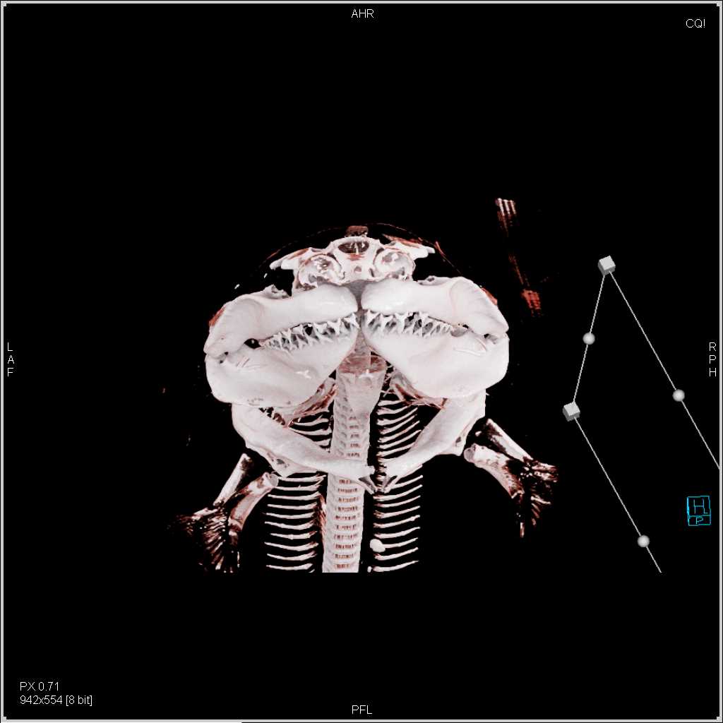 Sand Tiger Shark with Cinematic Rendering - CTisus CT Scan