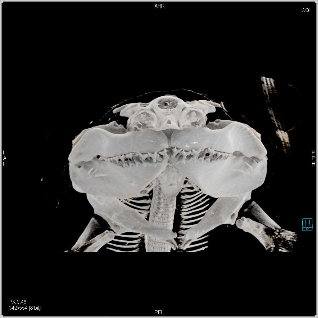 Sand Tiger Shark with Cinematic Rendering - CTisus CT Scan